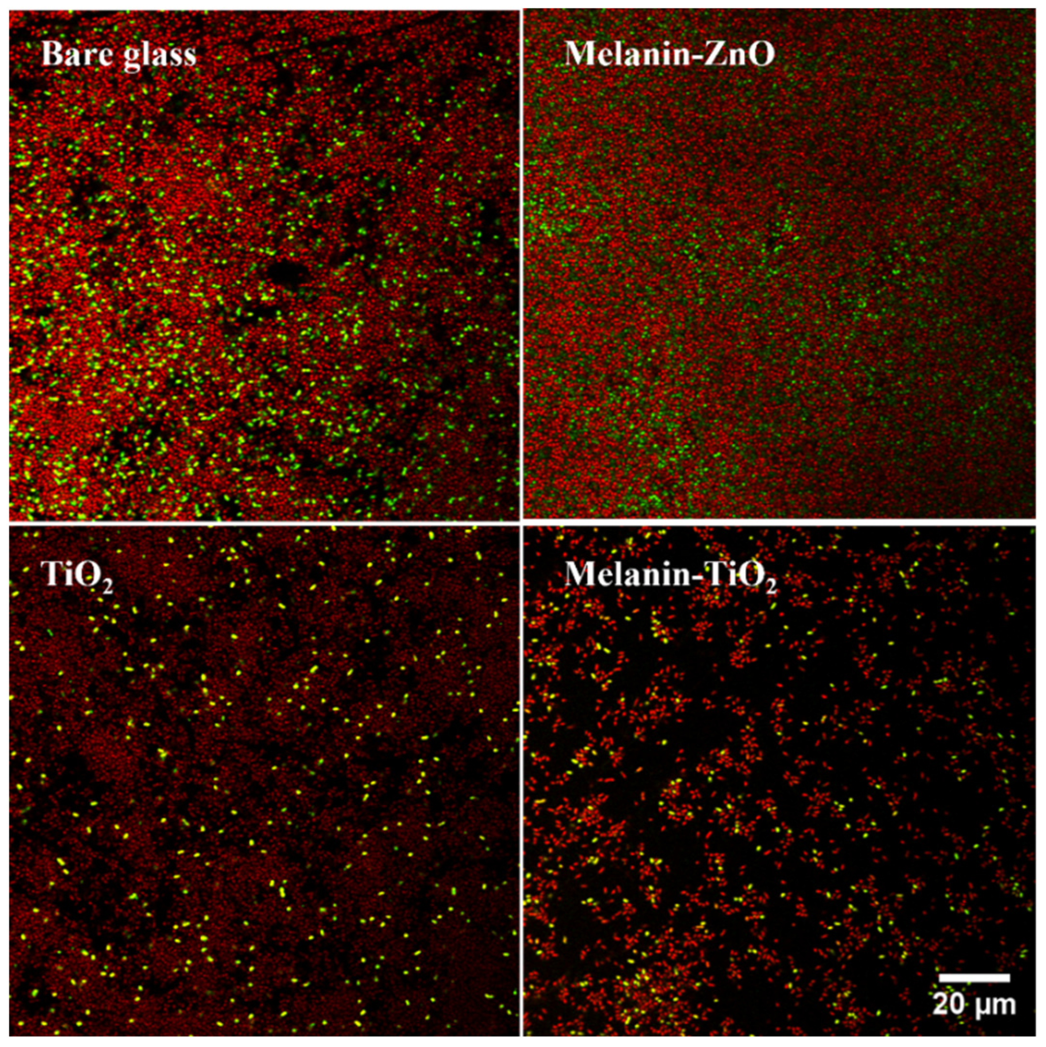 Microorganisms 11 00621 g004