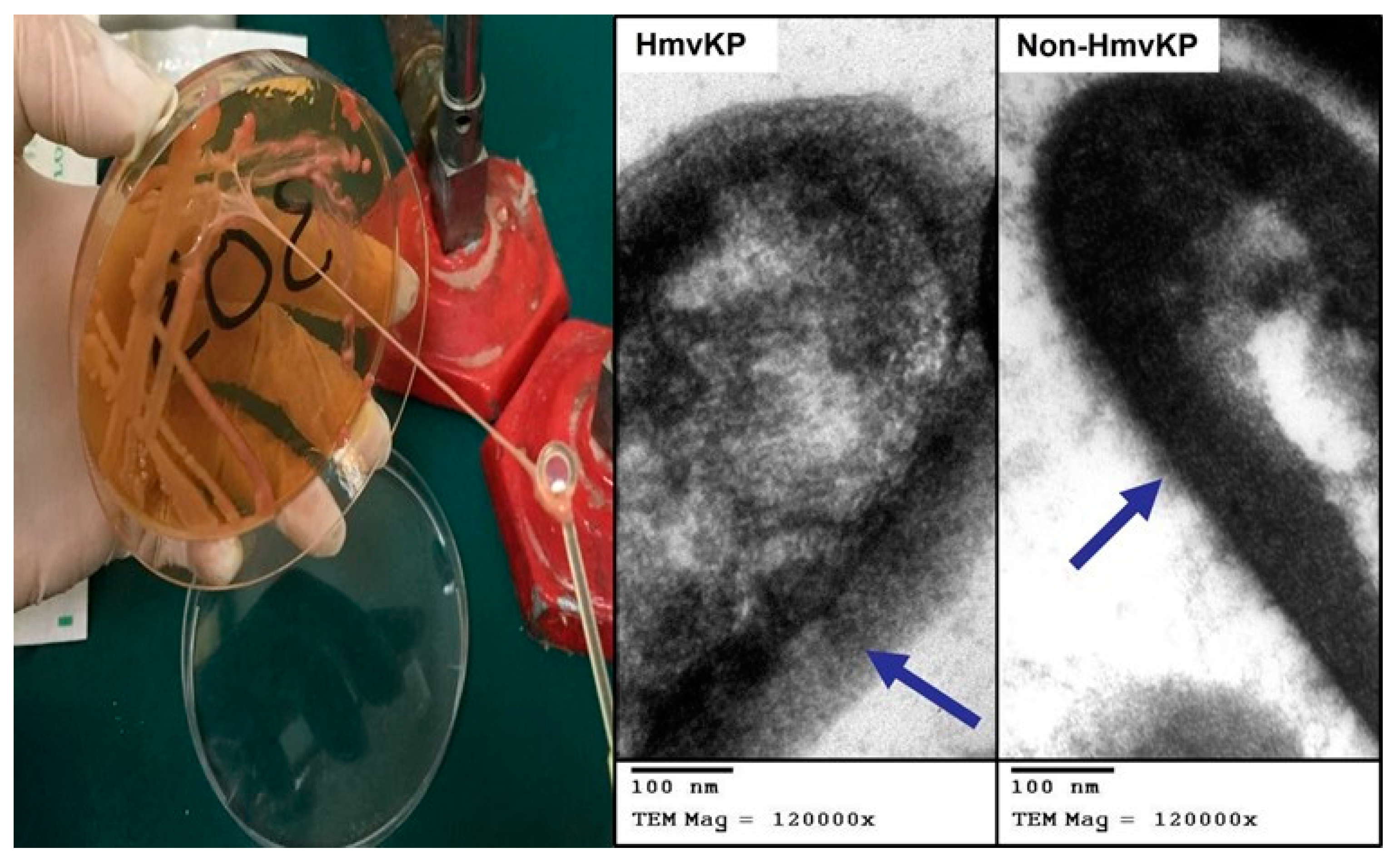 Microorganisms 11 00704 g001