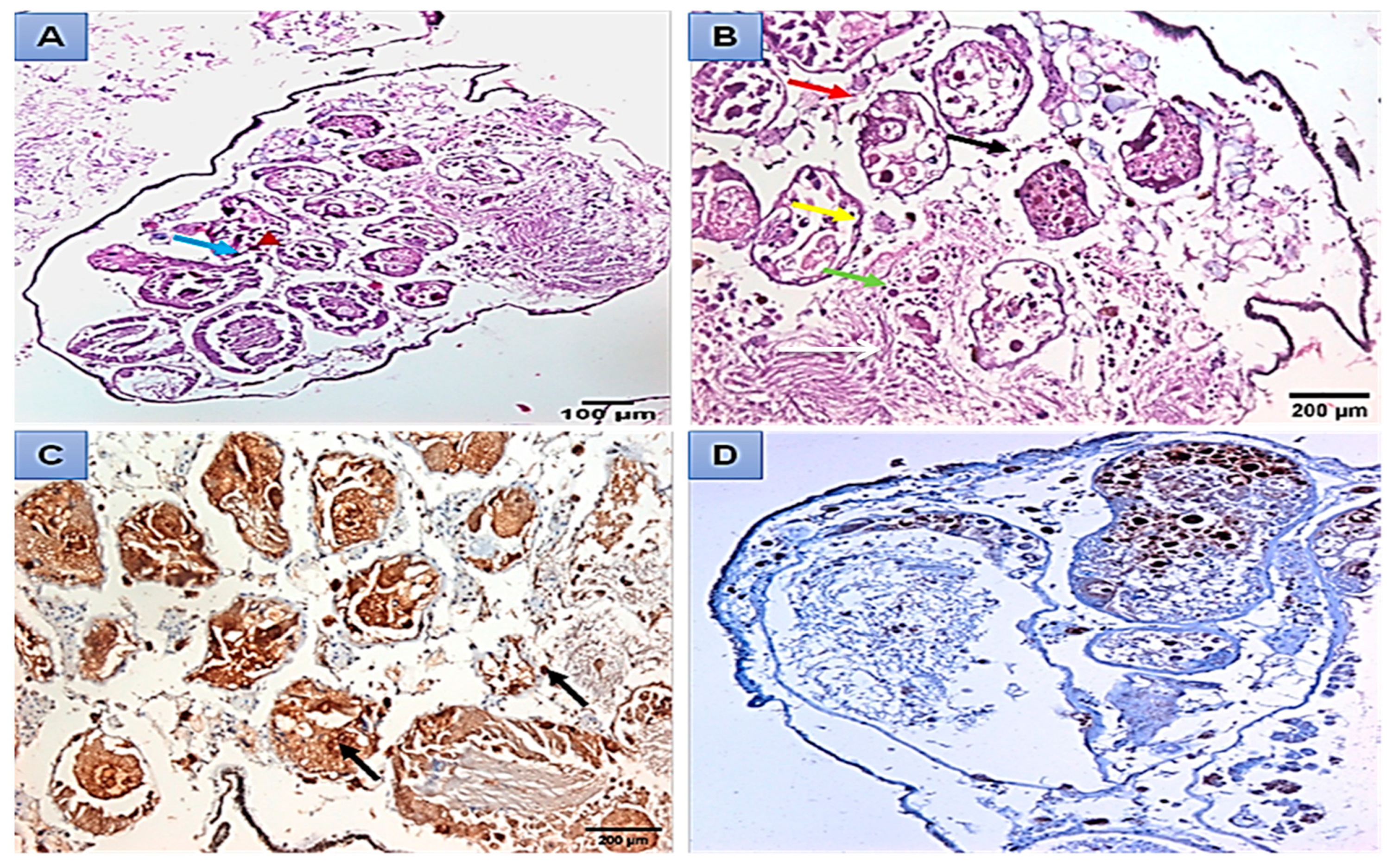 Microorganisms 11 00811 g006 Microorganisms 11 00811 g006