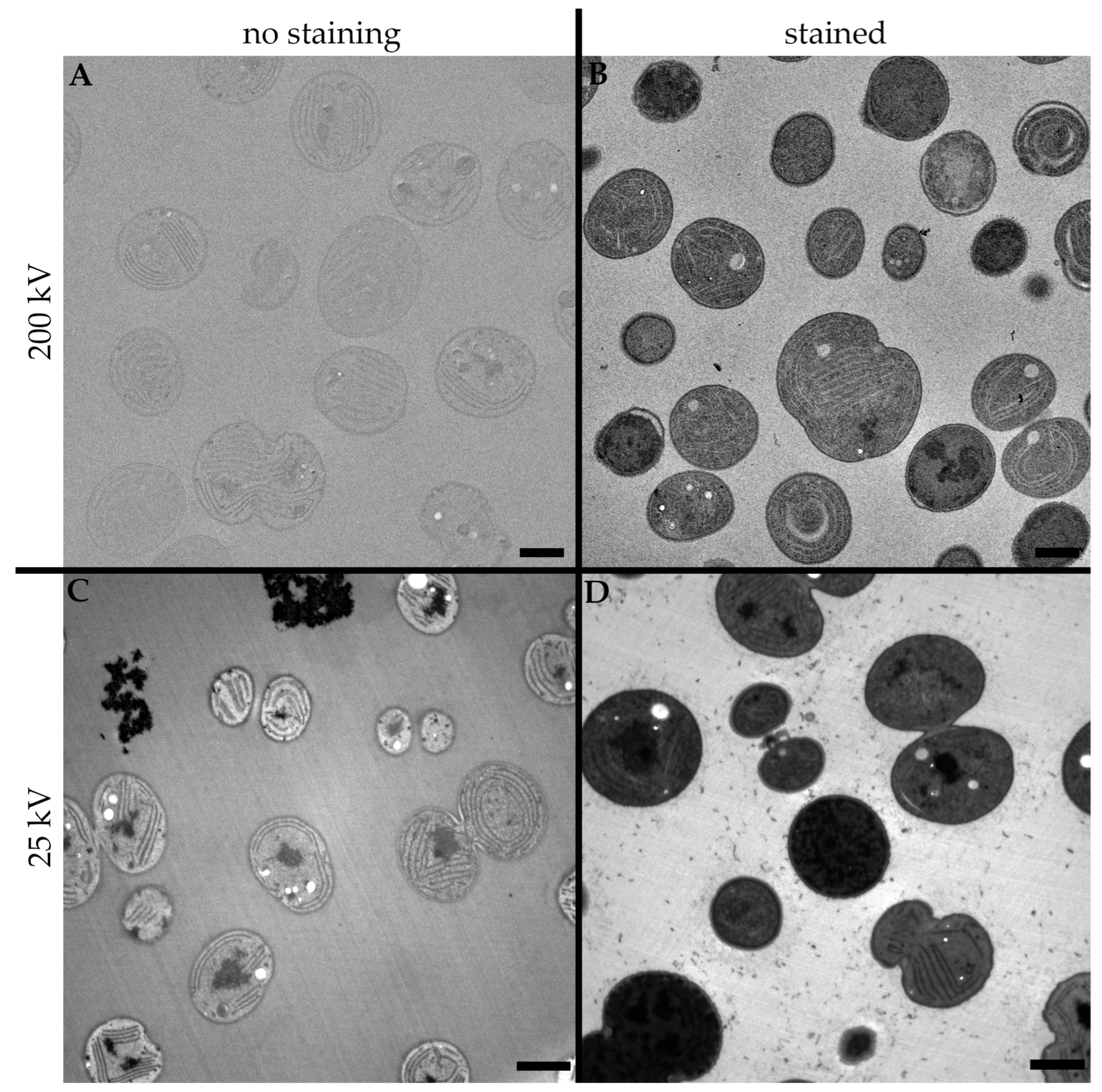 Microorganisms 11 00888 g002 Microorganisms 11 00888 g002