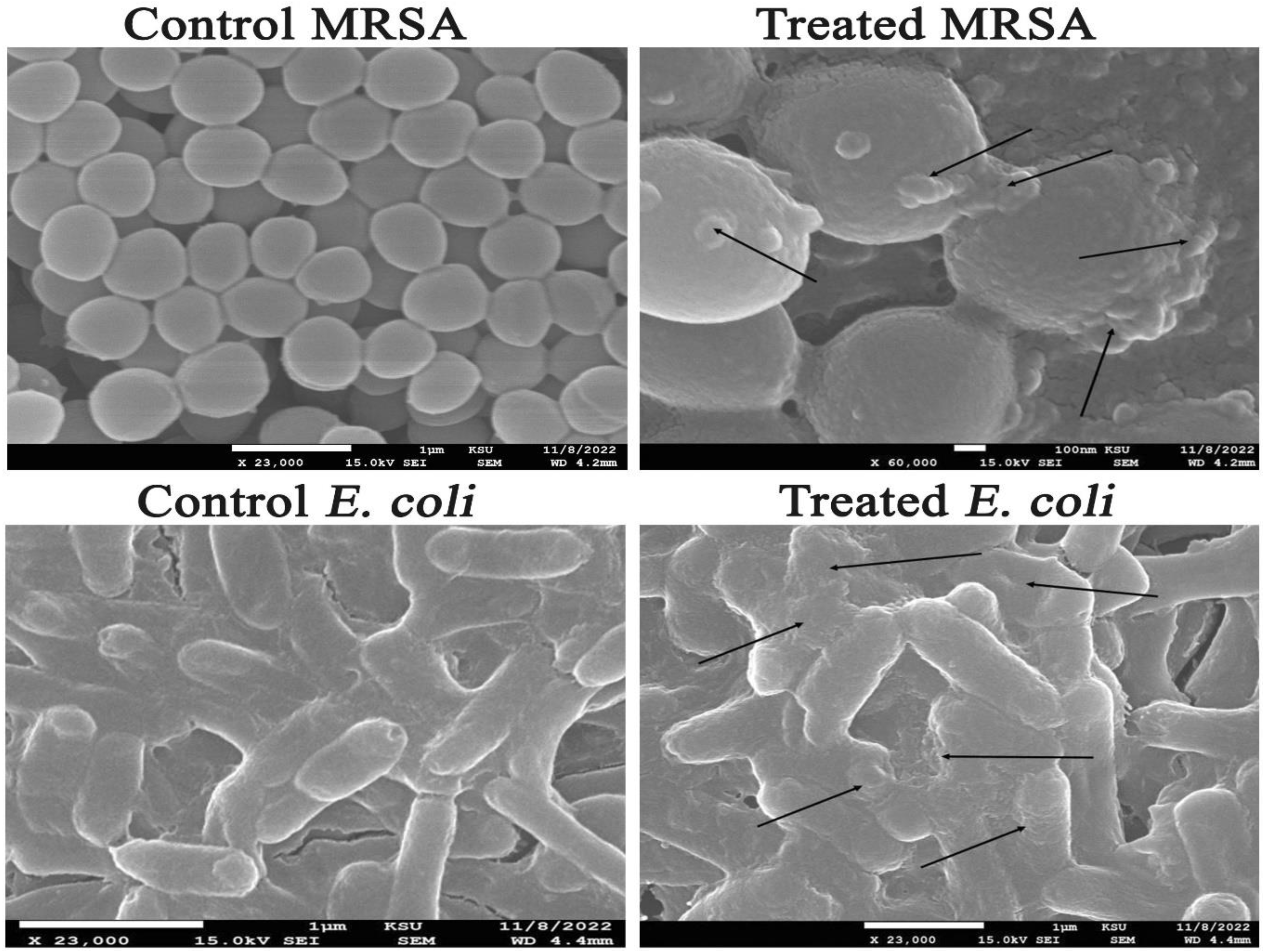Microorganisms 11 00945 g012