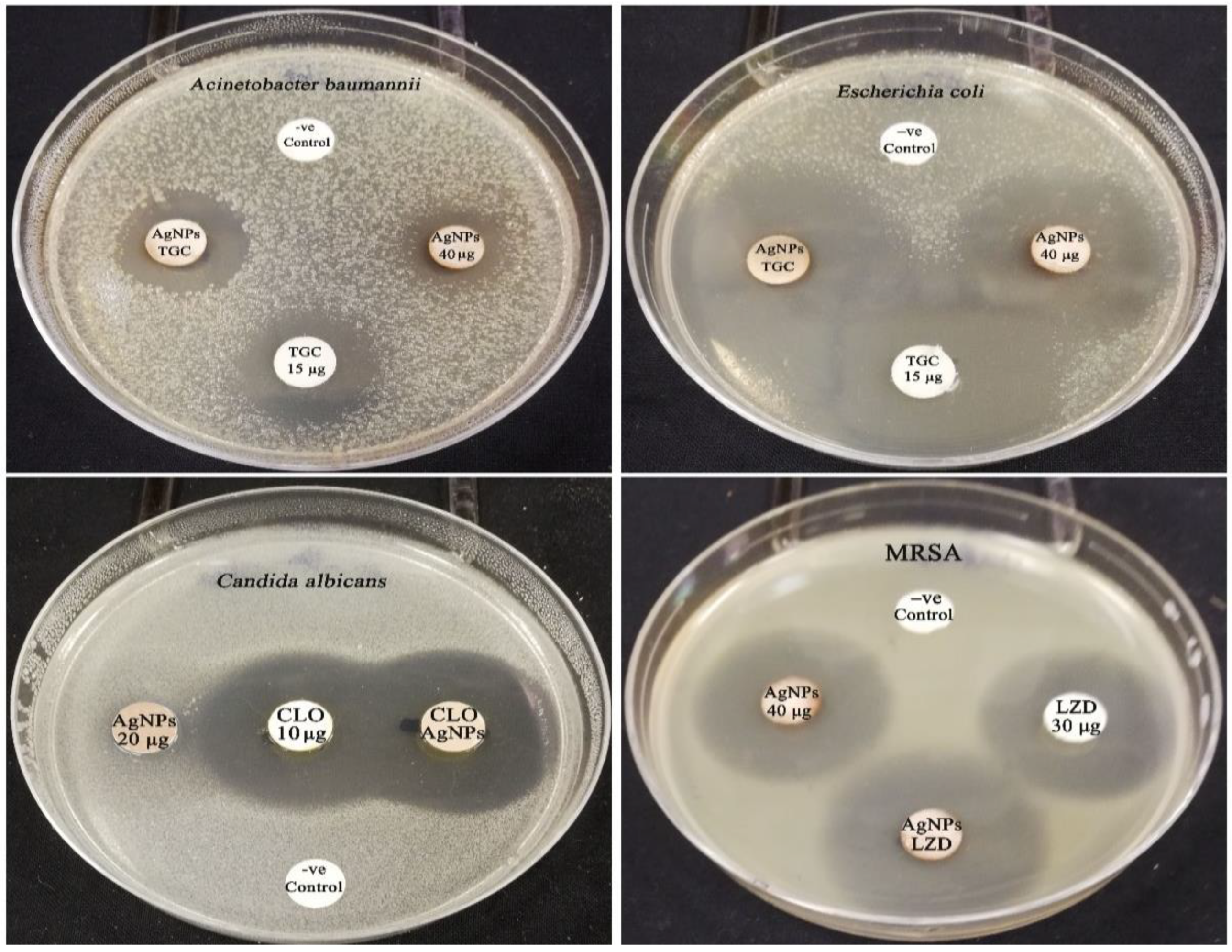 Microorganisms 11 00945 g013