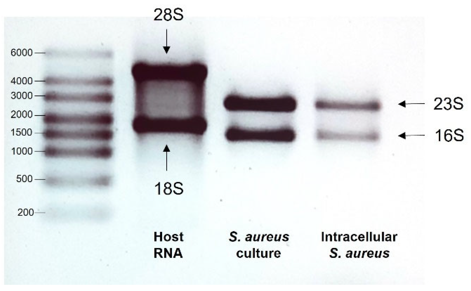 Microorganisms 11 01020 g001 Microorganisms 11 01020 g001