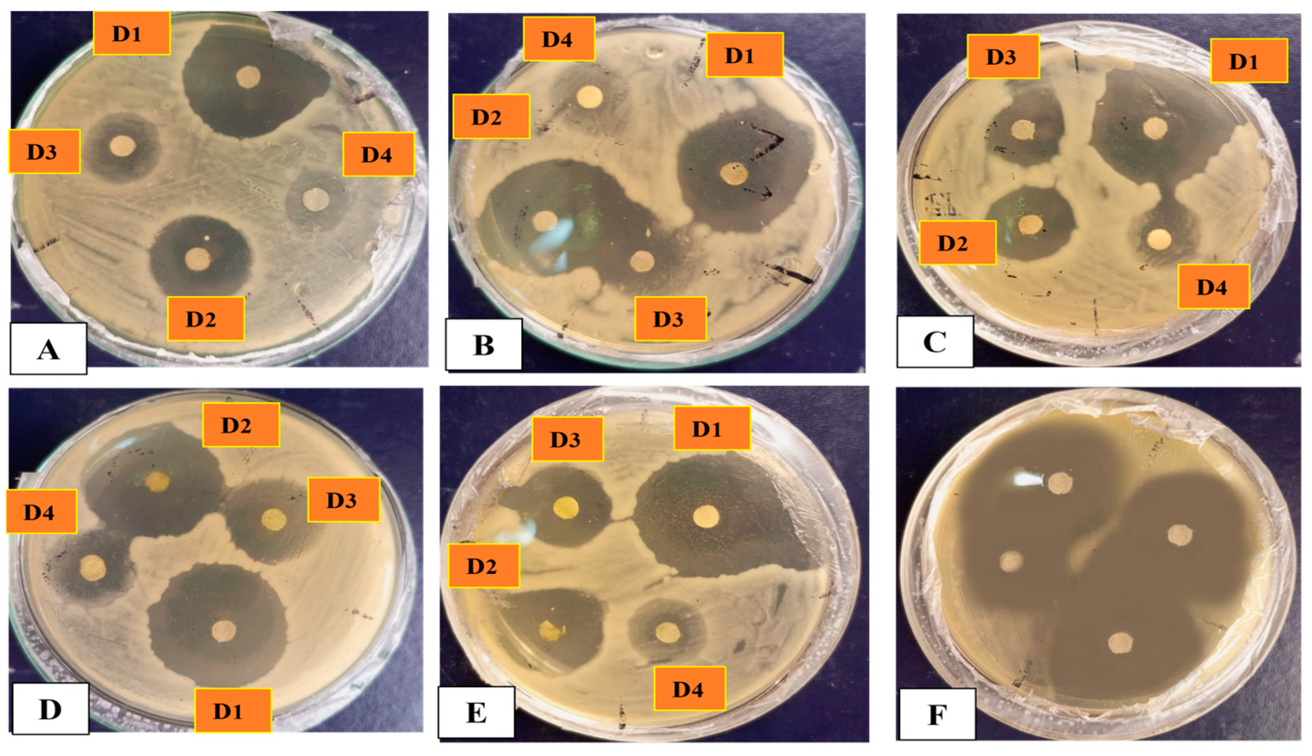 Microorganisms 11 01069 g011