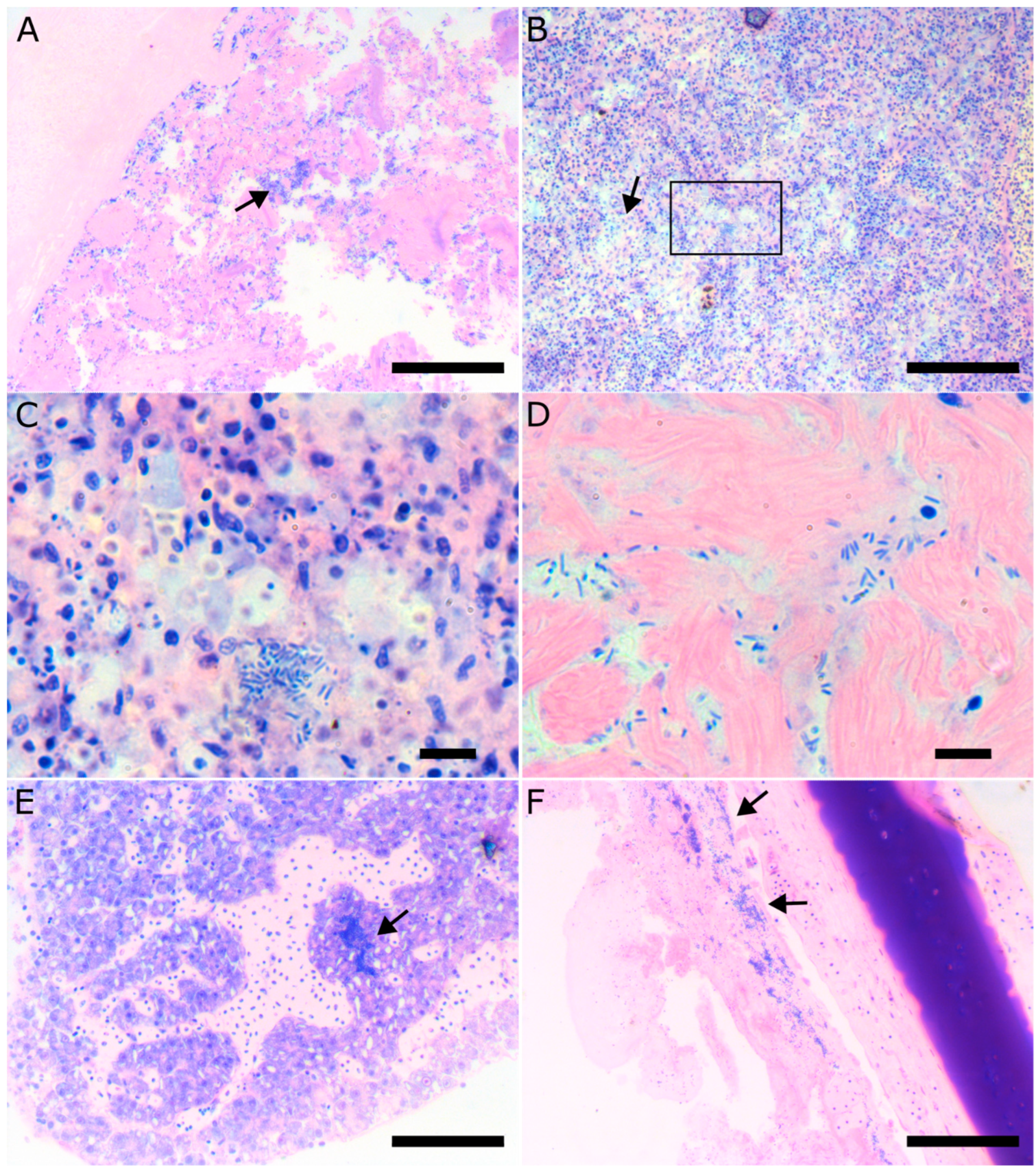 Microorganisms 11 01197 g006