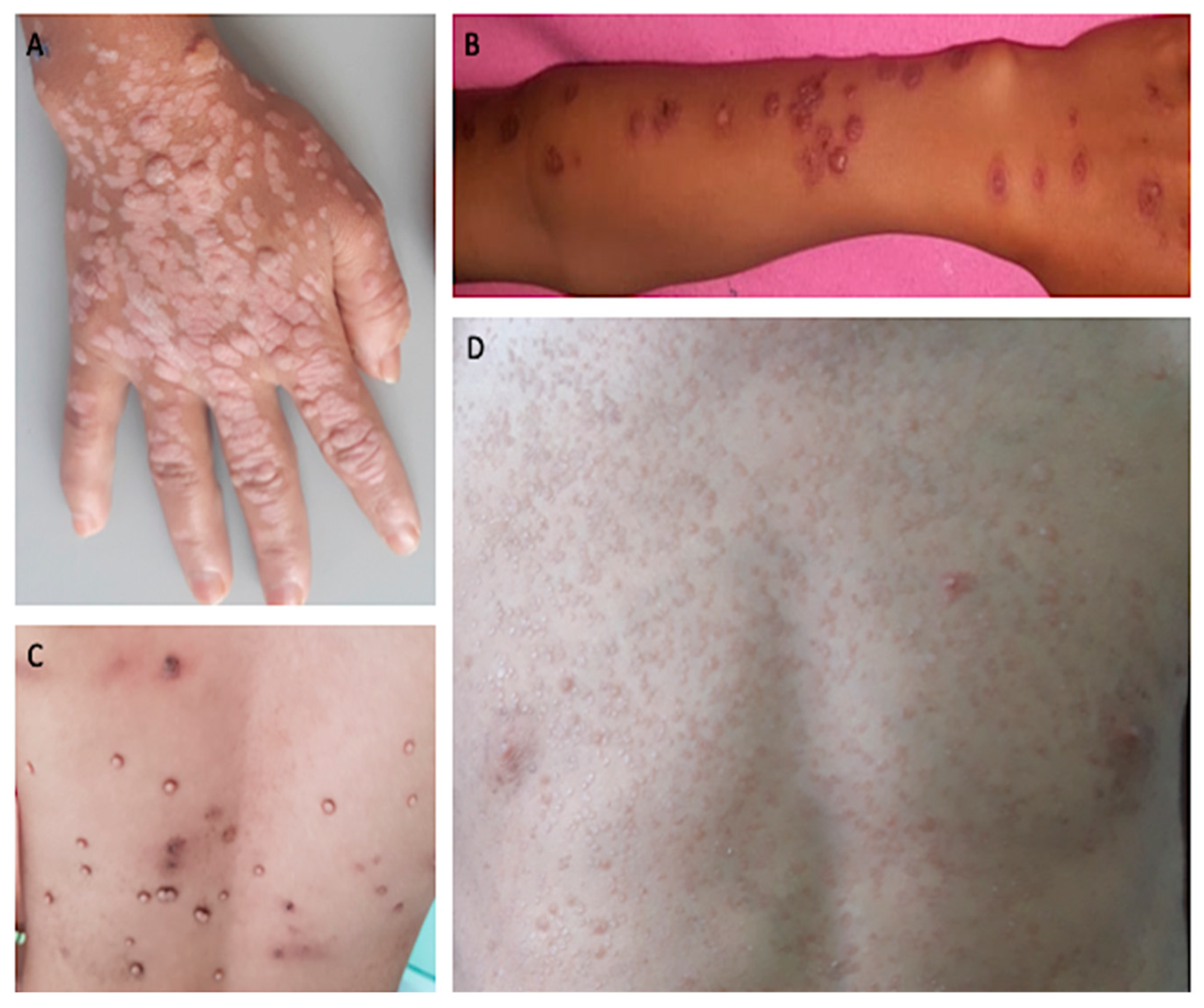 Microorganisms 11 01202 g001