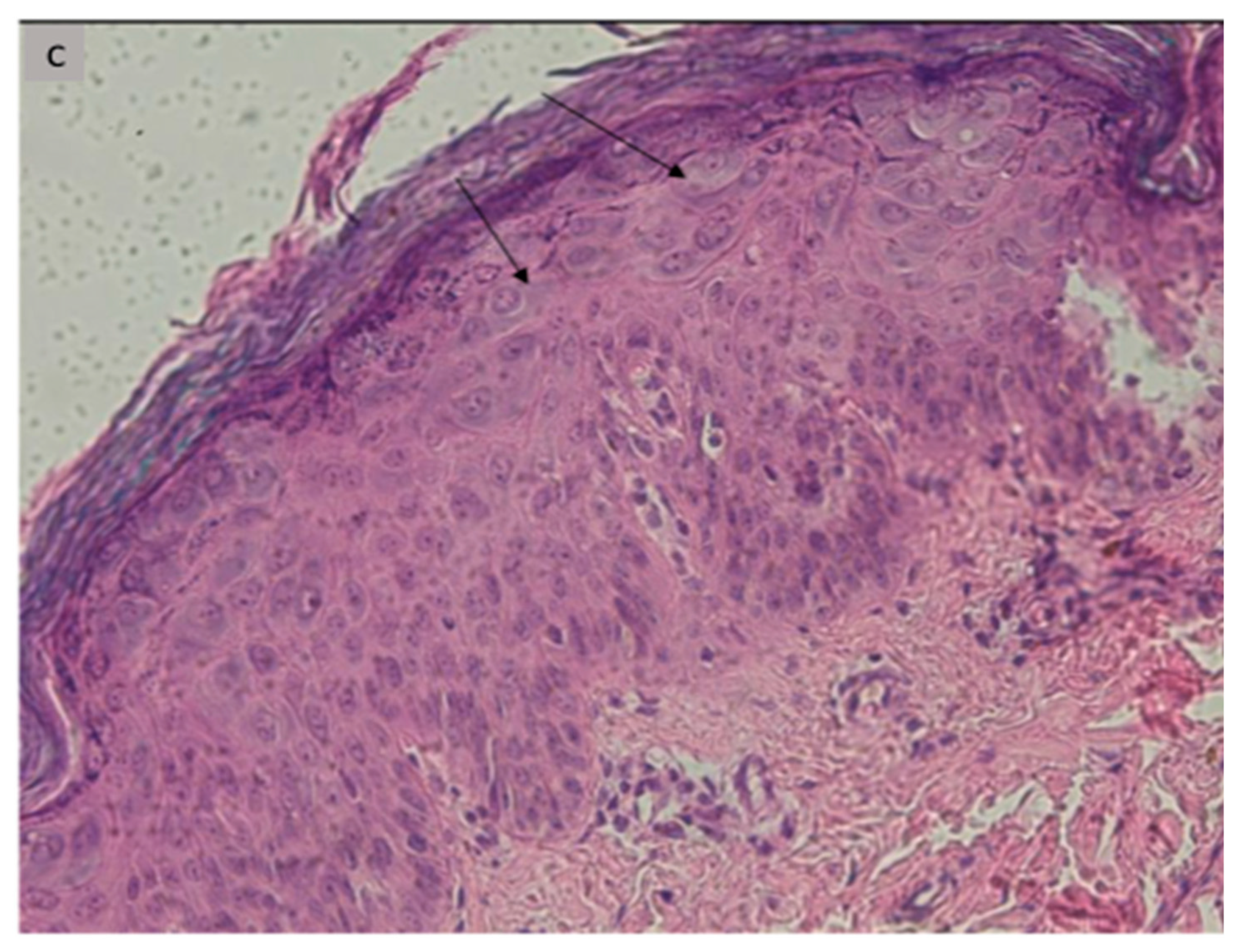 Microorganisms 11 01202 g002b