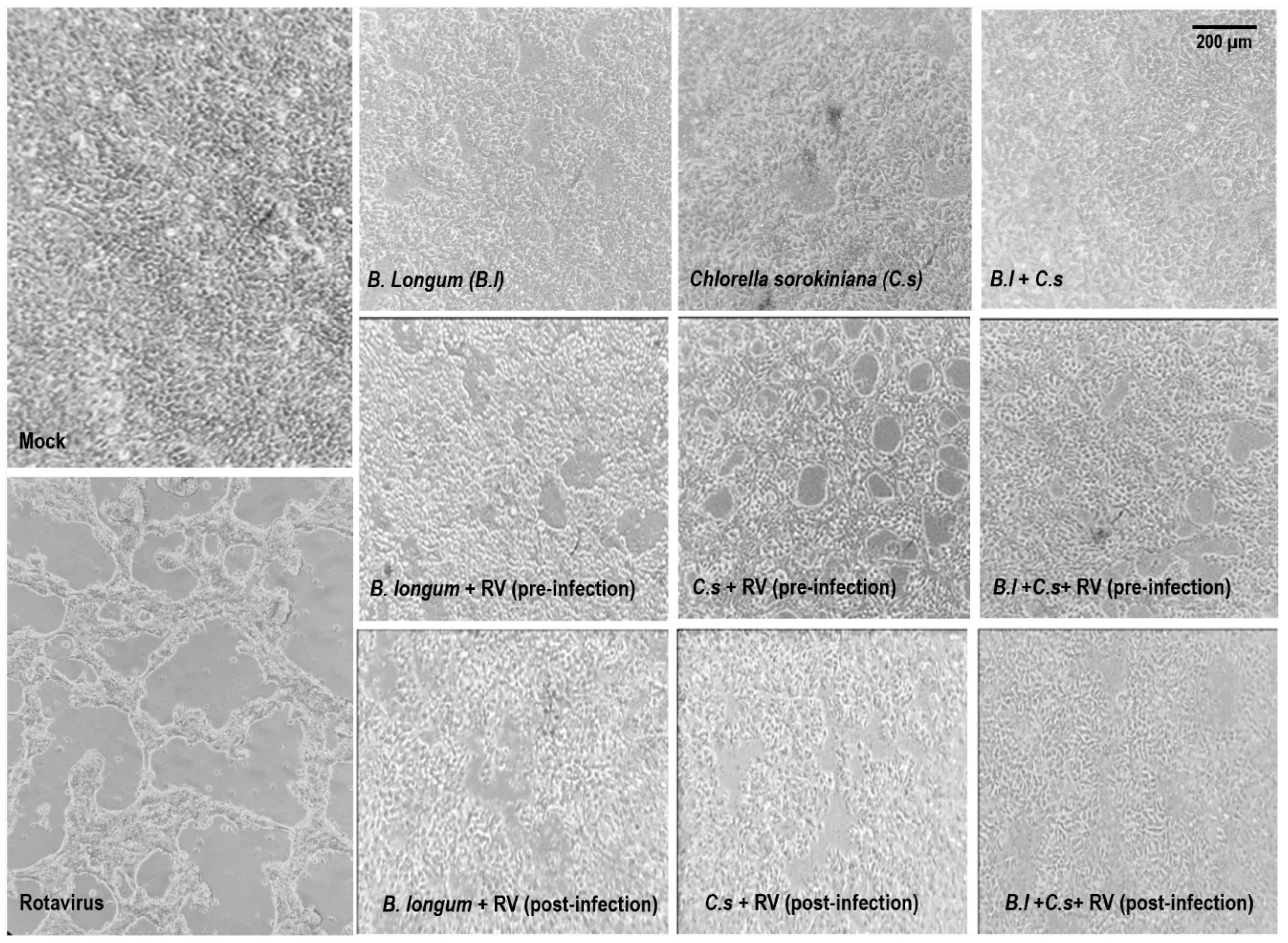 Microorganisms 11 01237 g001 Microorganisms 11 01237 g001