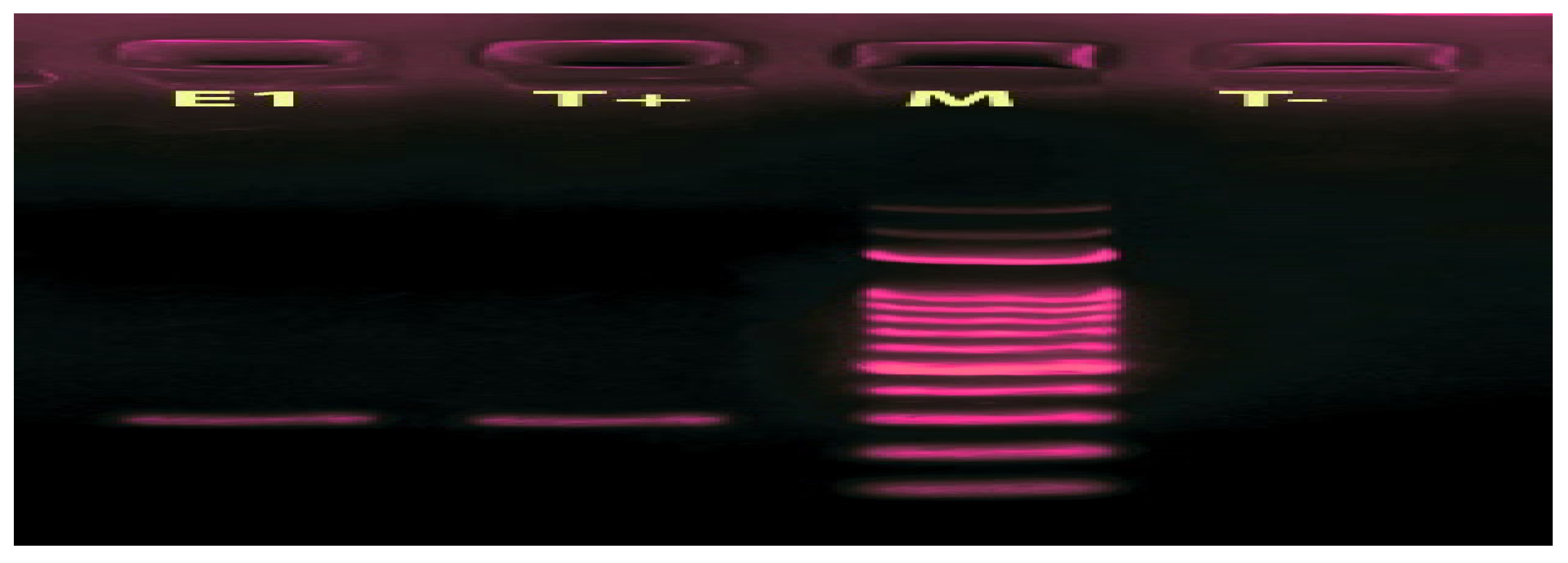 Microorganisms 11 01242 g001 Microorganisms 11 01242 g001