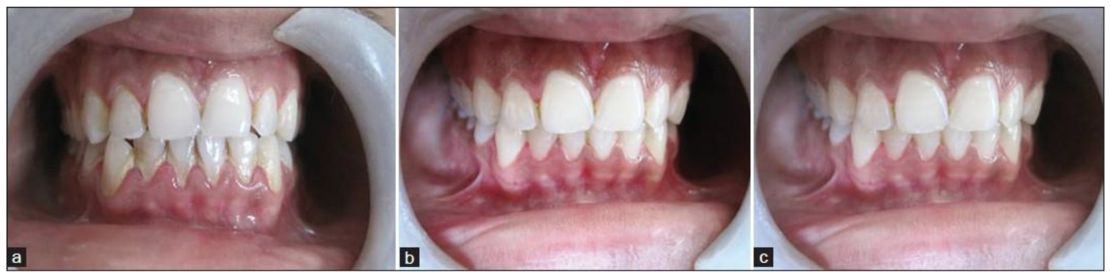 Microorganisms 11 01269 g006 Microorganisms 11 01269 g006