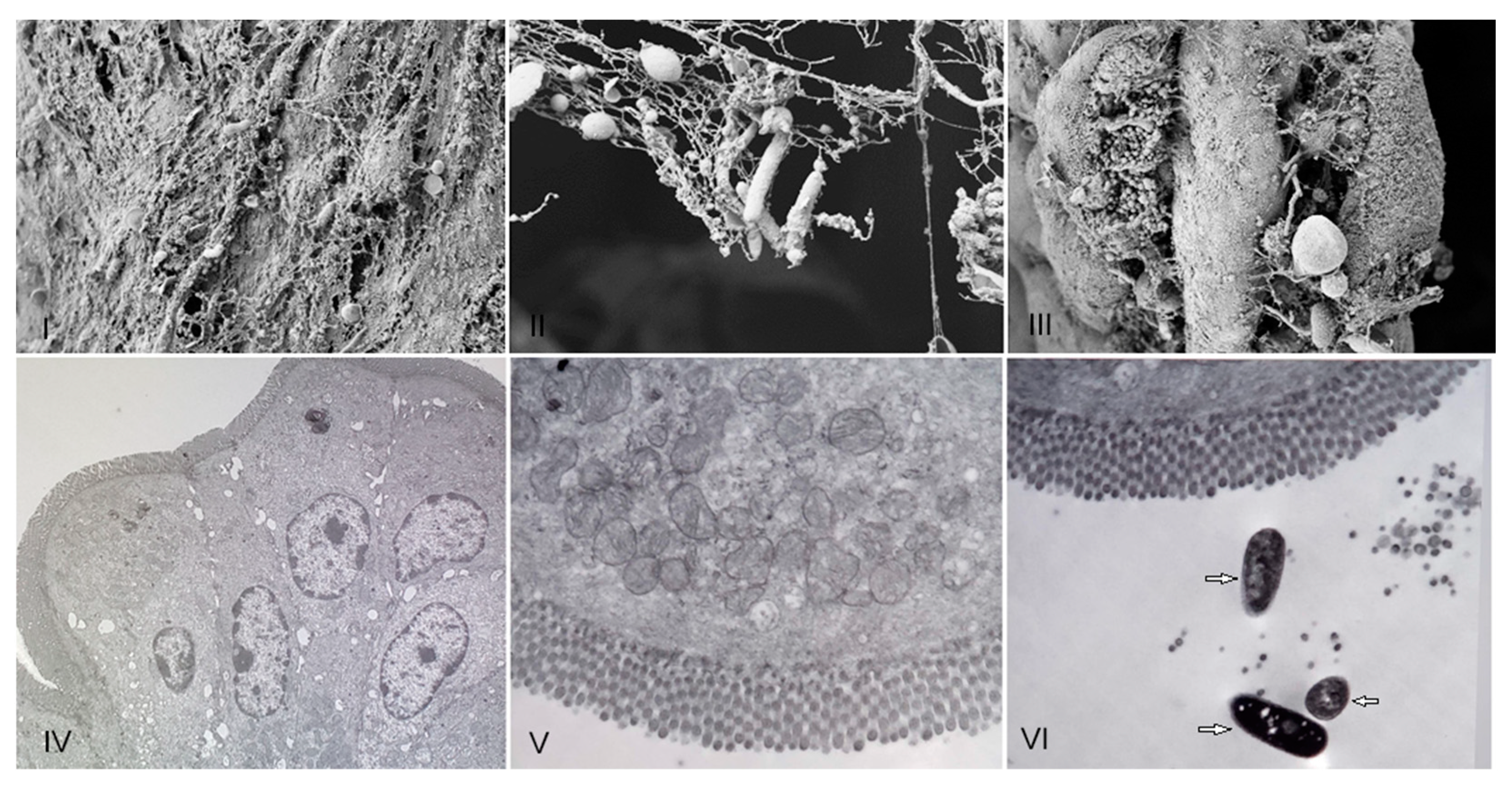 Microorganisms 11 01347 g002
