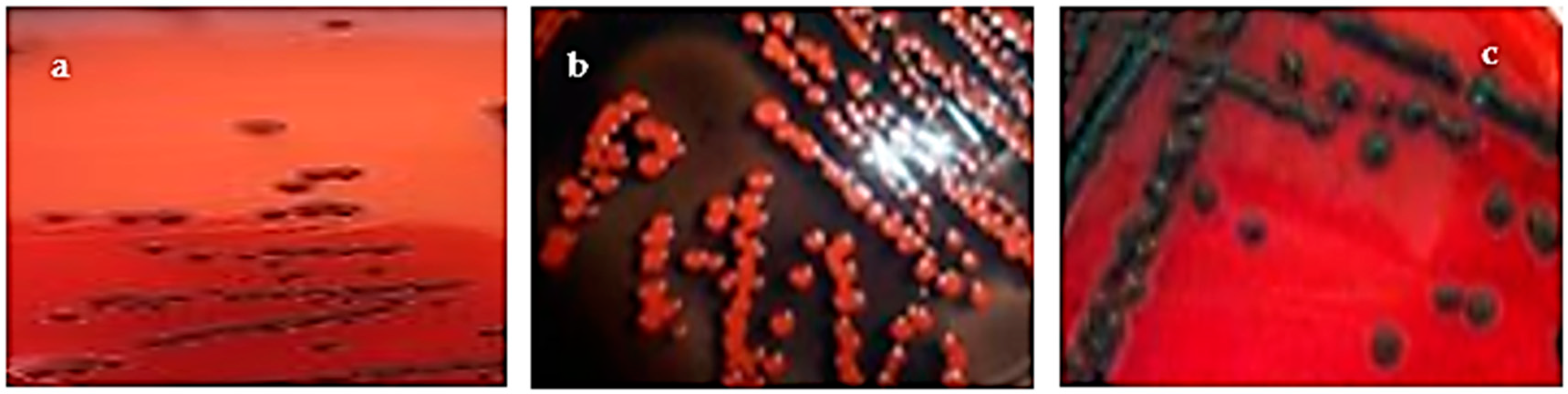 Microorganisms 11 01353 g001 Microorganisms 11 01353 g001