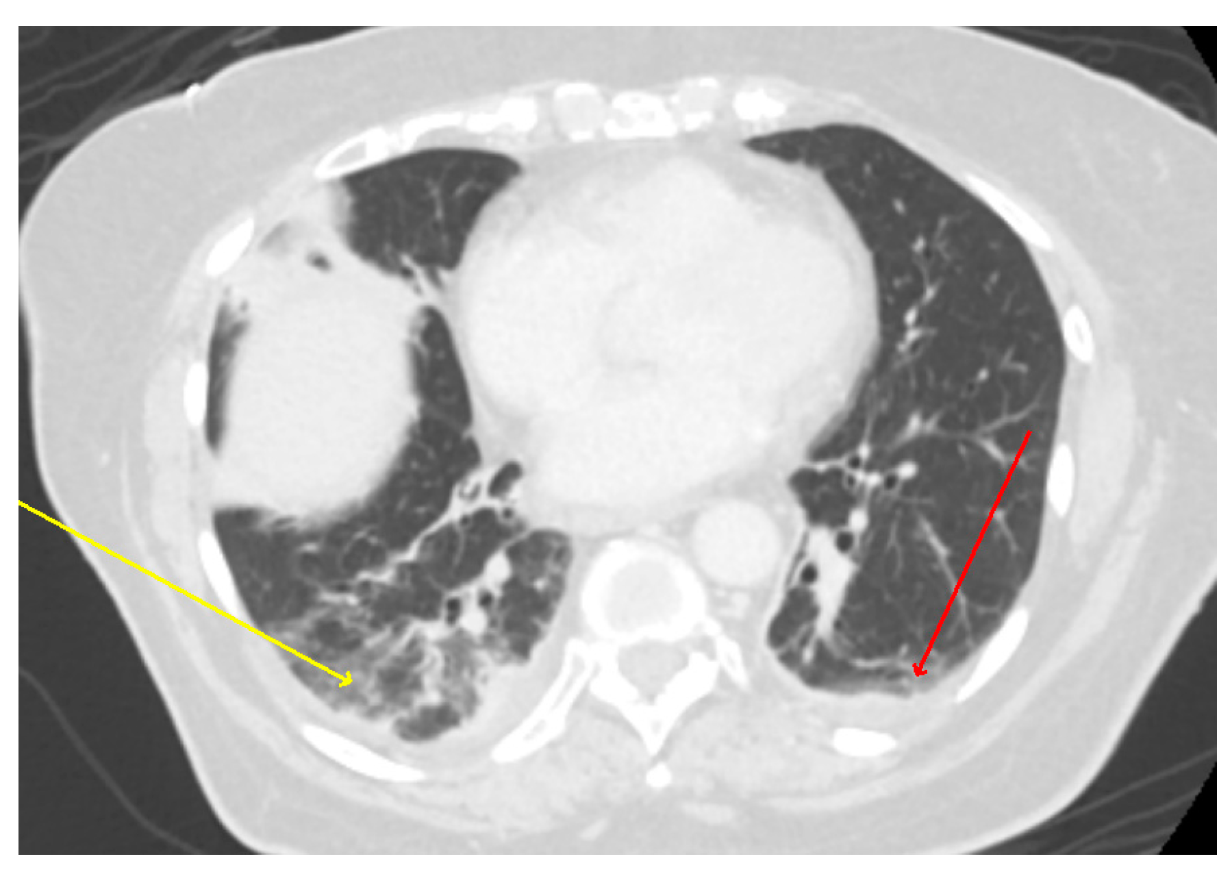 Microorganisms 11 01483 g002 Microorganisms 11 01483 g002