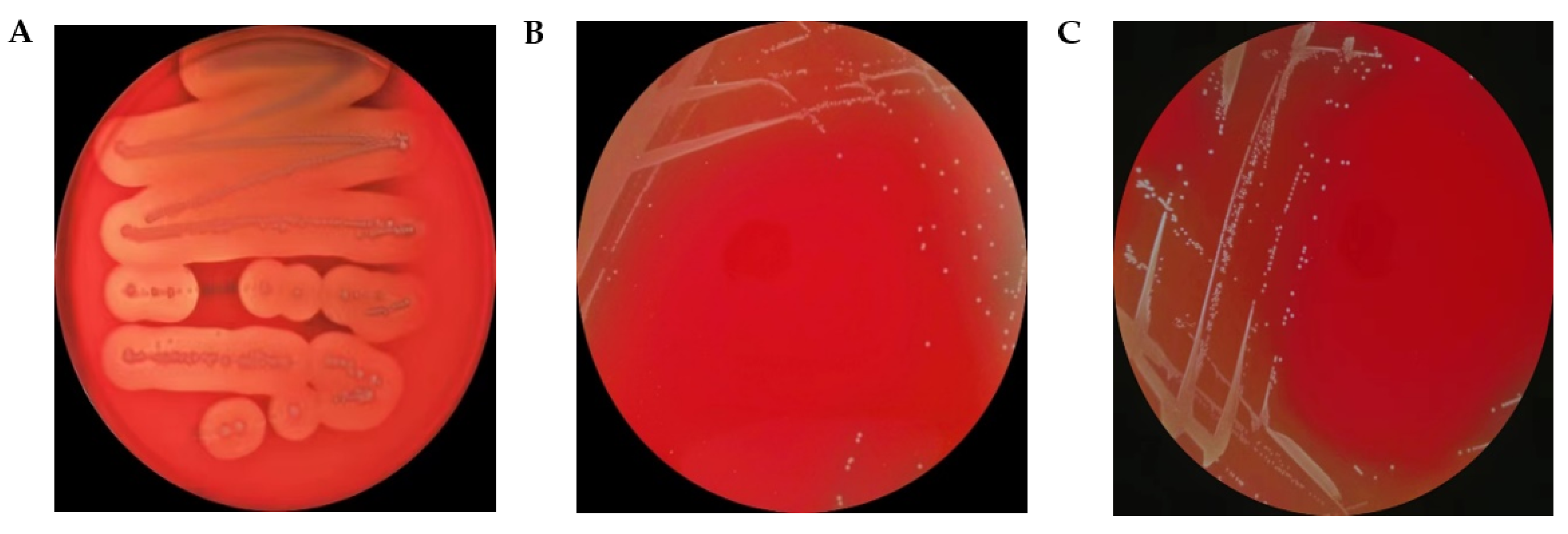 Microorganisms 11 01620 g002 Microorganisms 11 01620 g002