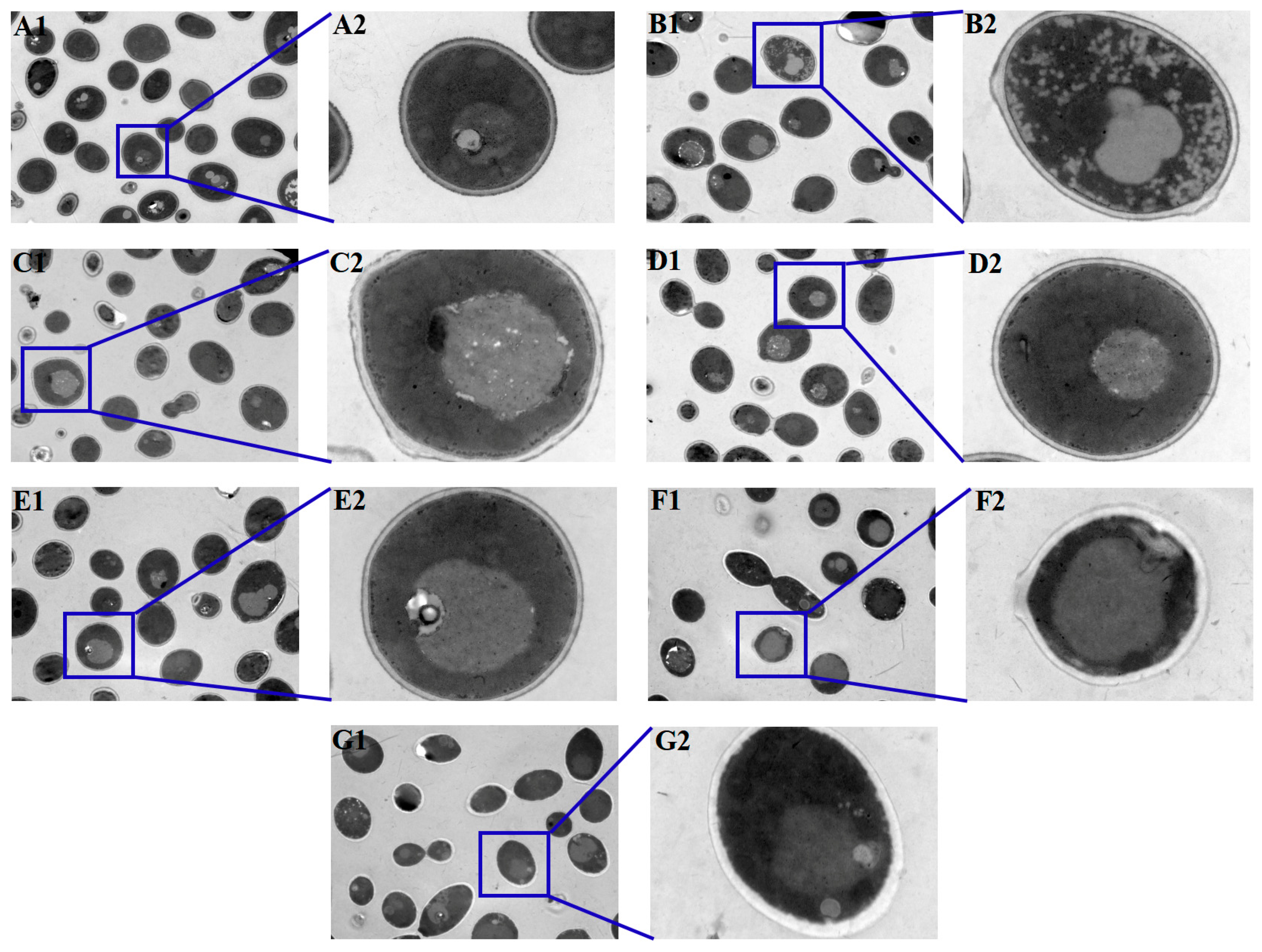 Microorganisms 11 02015 g007