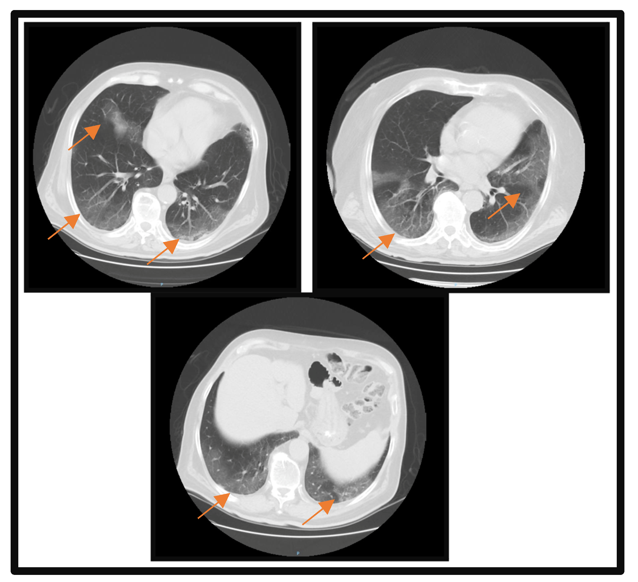 Microorganisms 11 02143 g001 Microorganisms 11 02143 g001