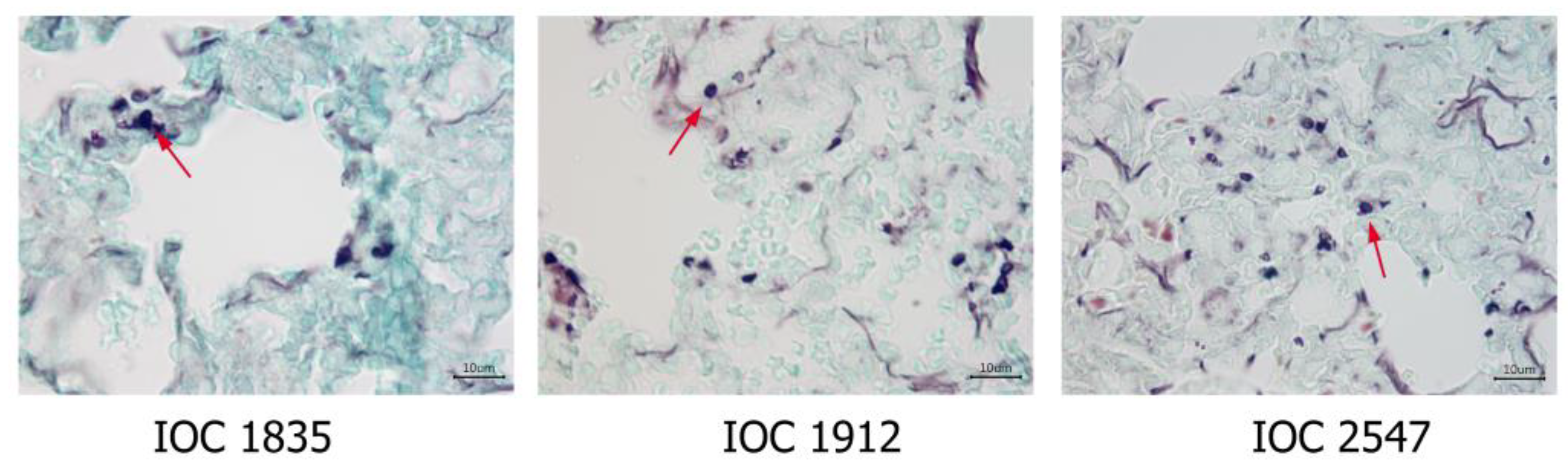Microorganisms 11 02335 g005 Microorganisms 11 02335 g005