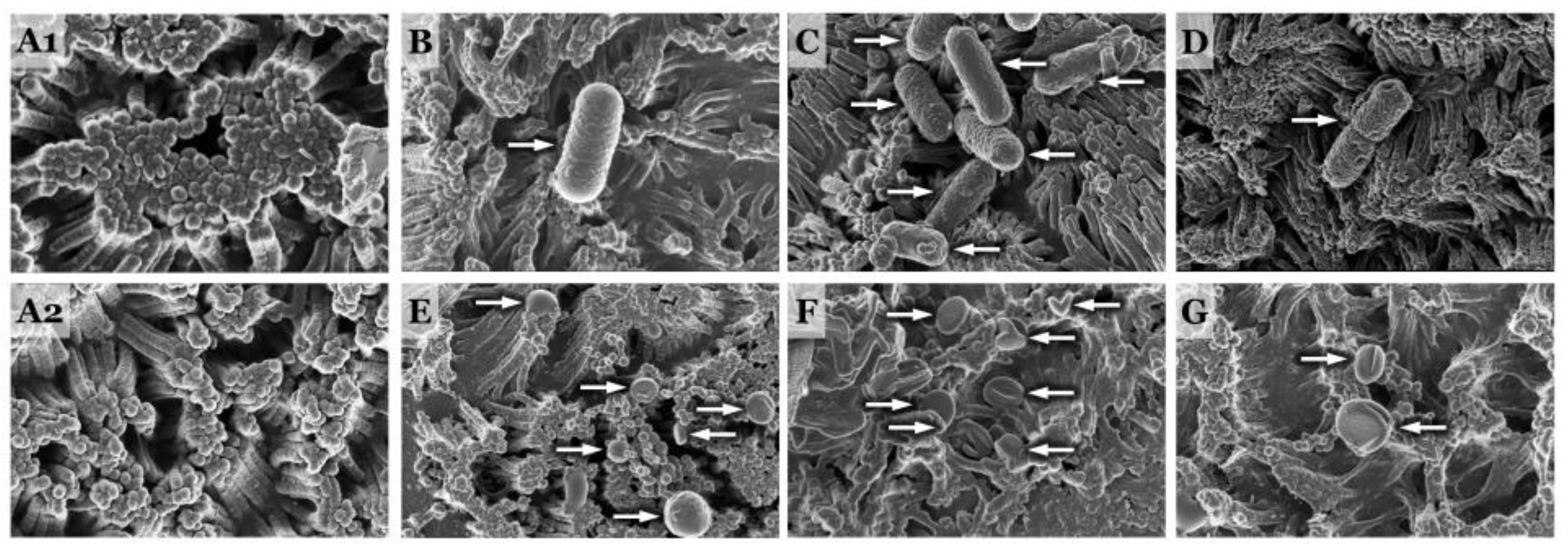 Microorganisms 11 02942 g005