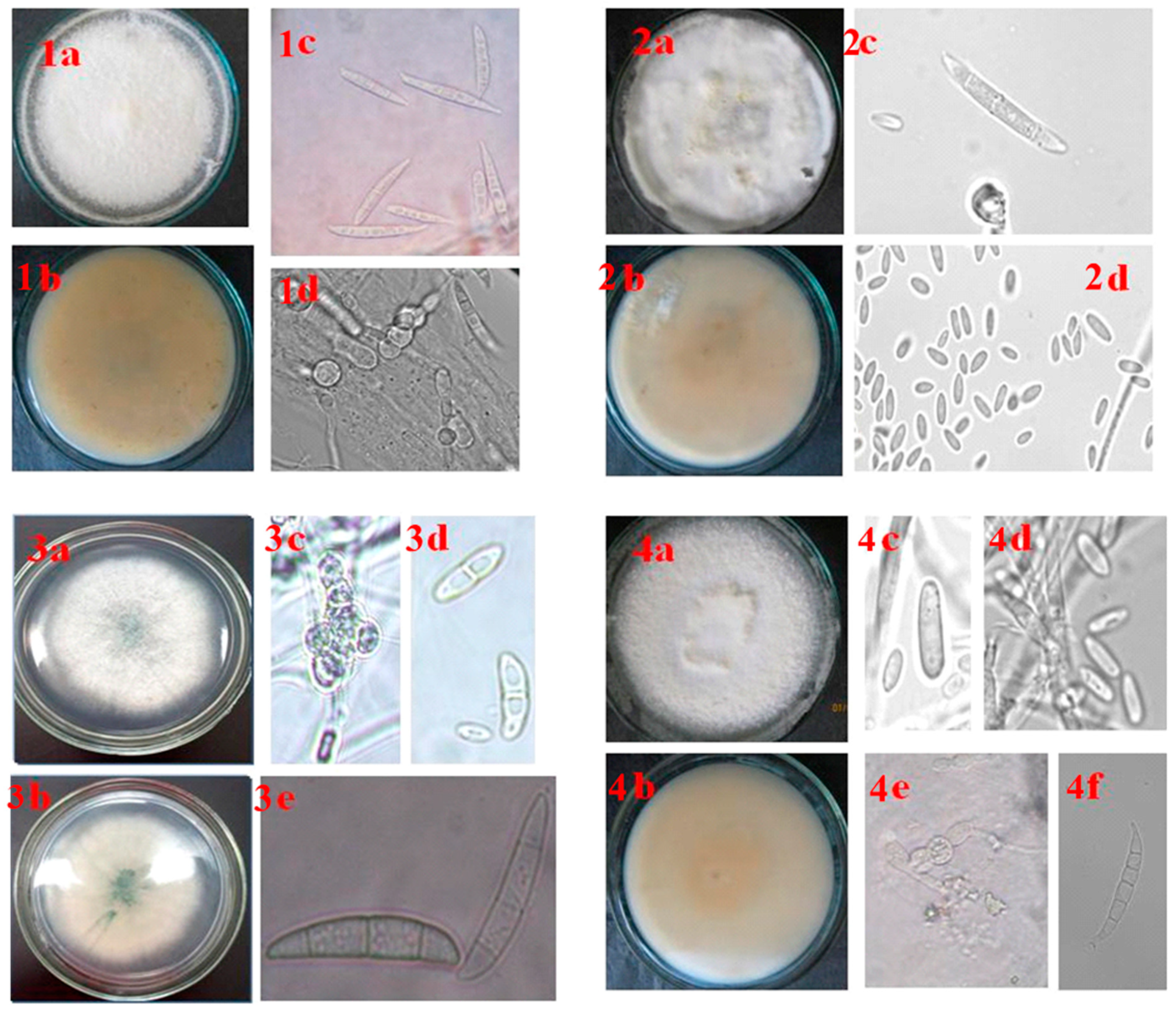 Microorganisms 12 00343 g008