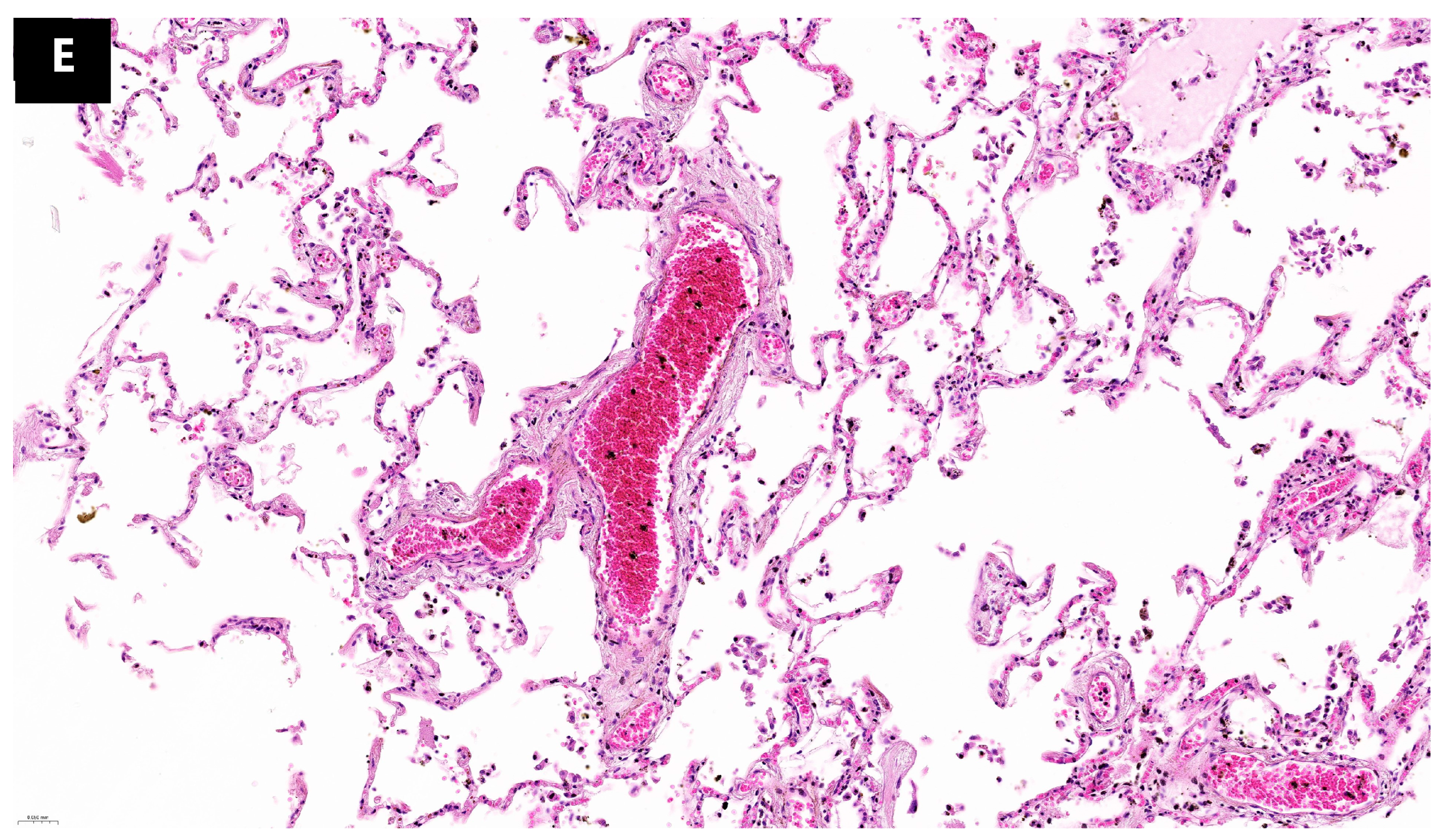 Microorganisms 12 00459 g002b