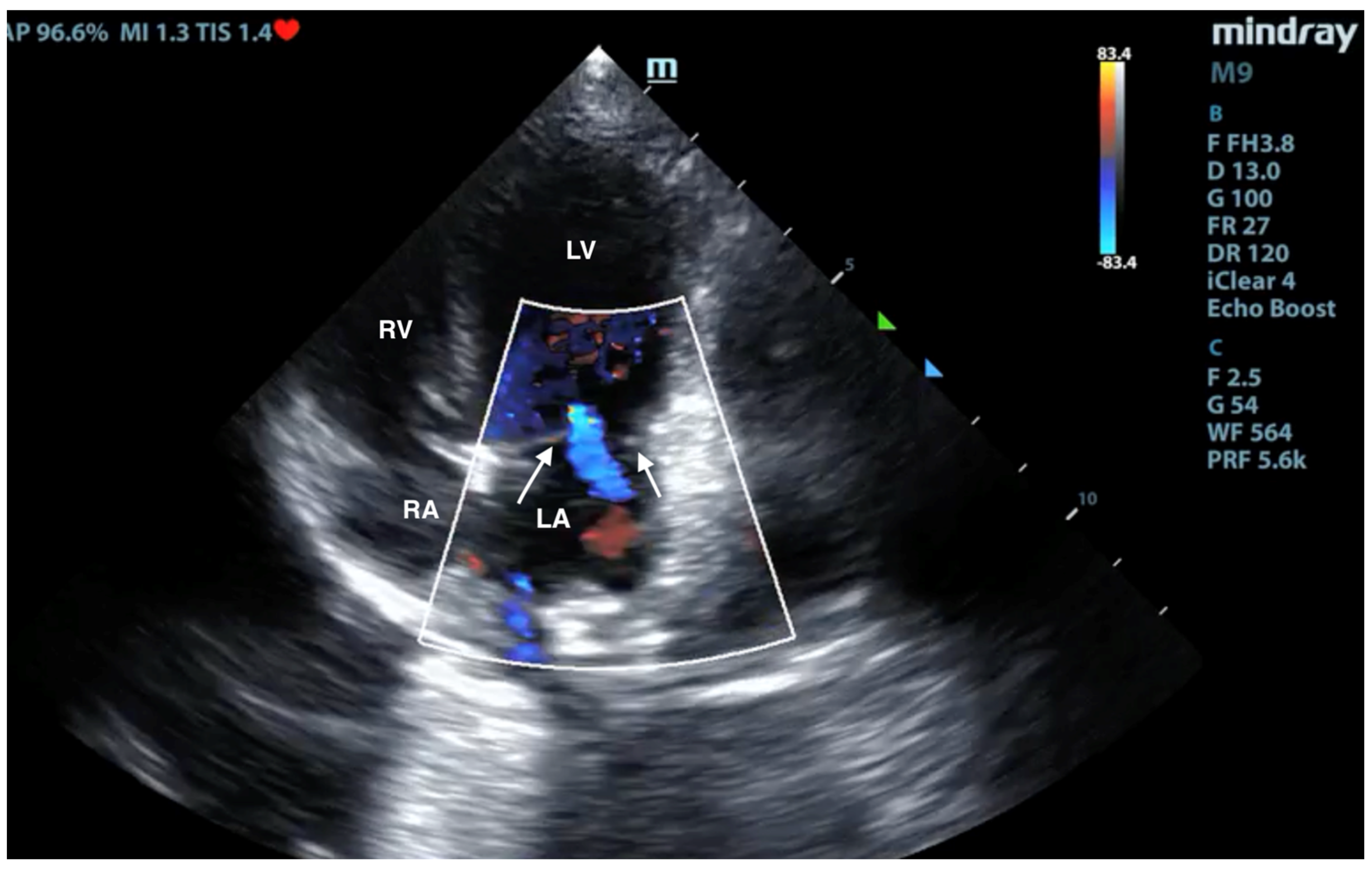 Microorganisms 12 00689 g004