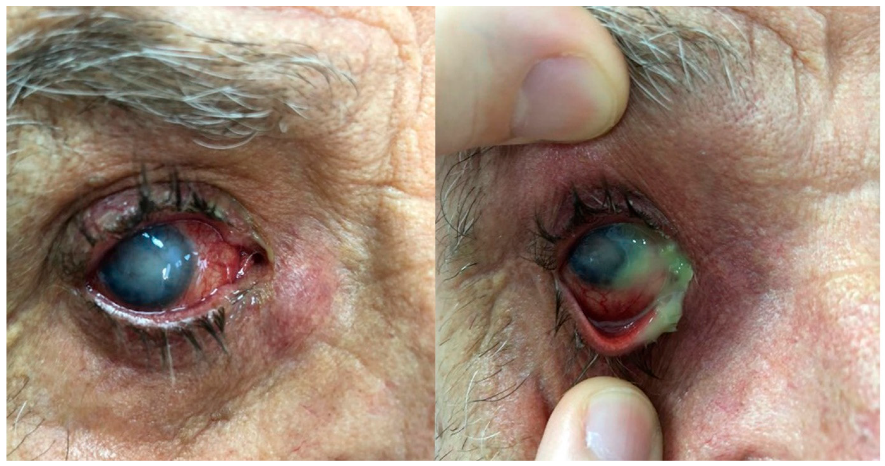 Microorganisms 12 00787 g001