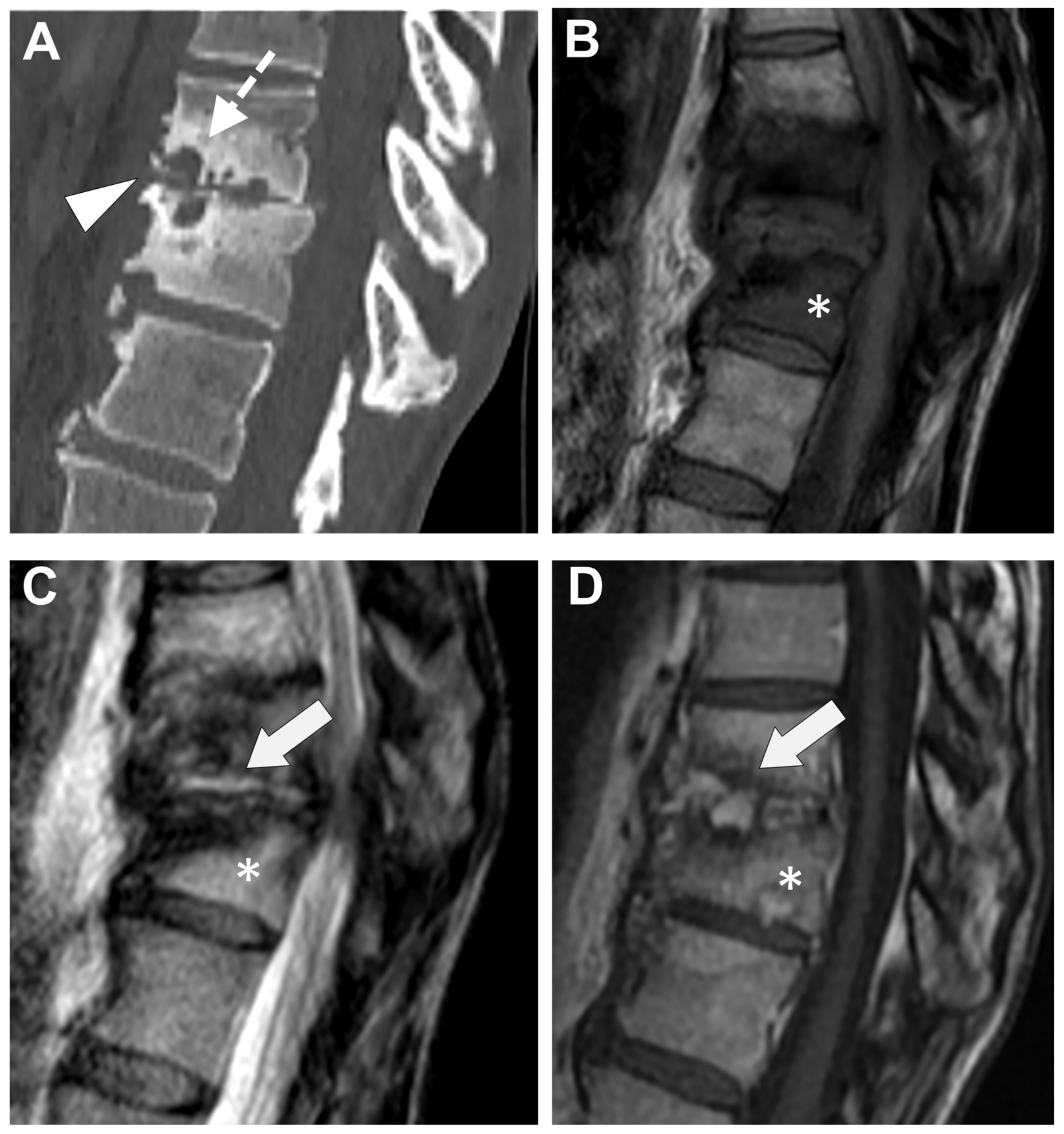 Microorganisms 12 00893 g012