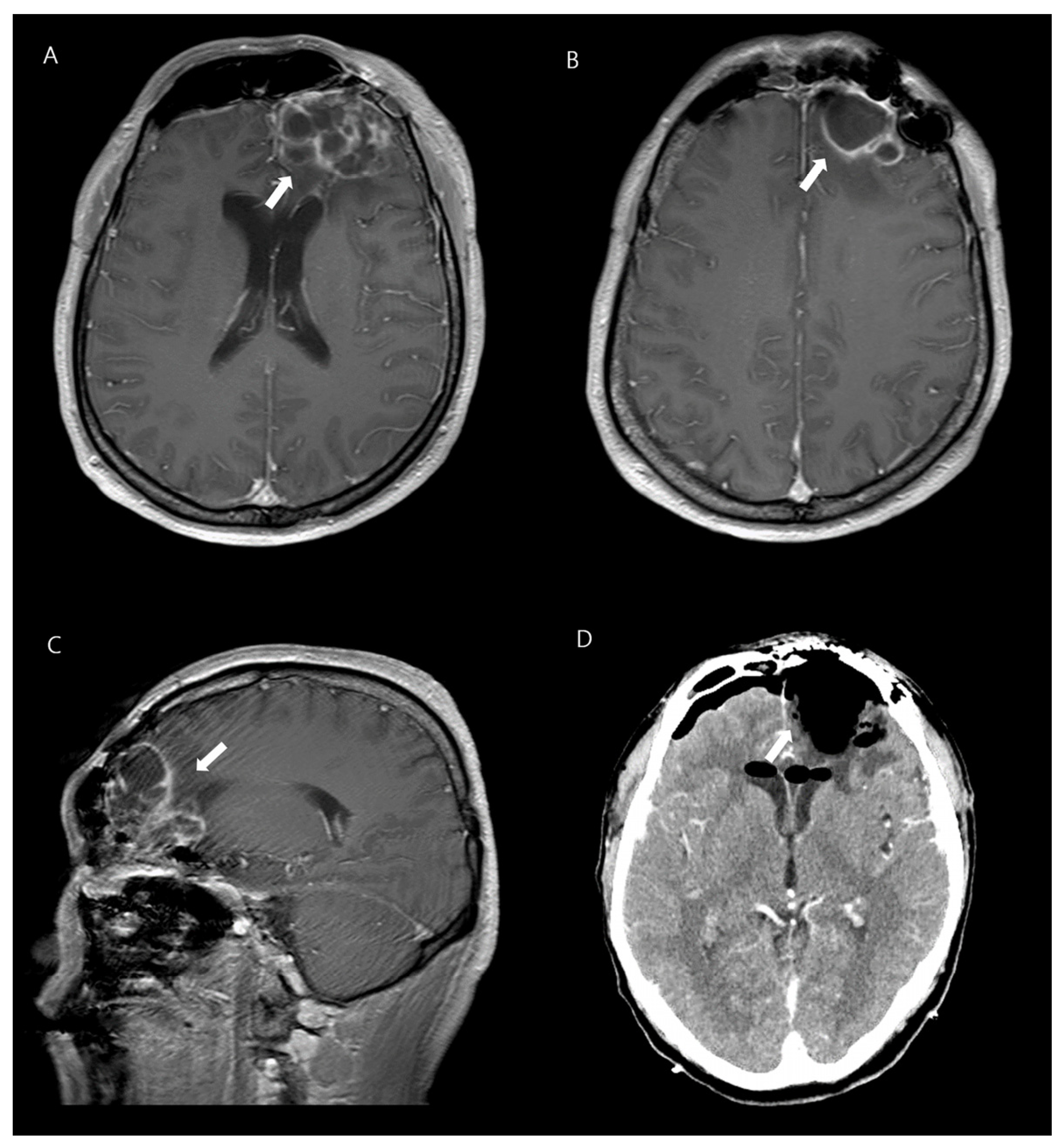 Microorganisms 12 00894 g001