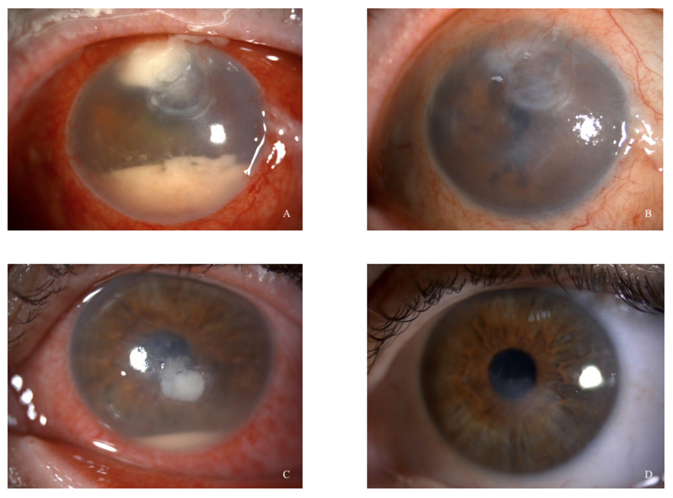 Microorganisms 12 00922 g001