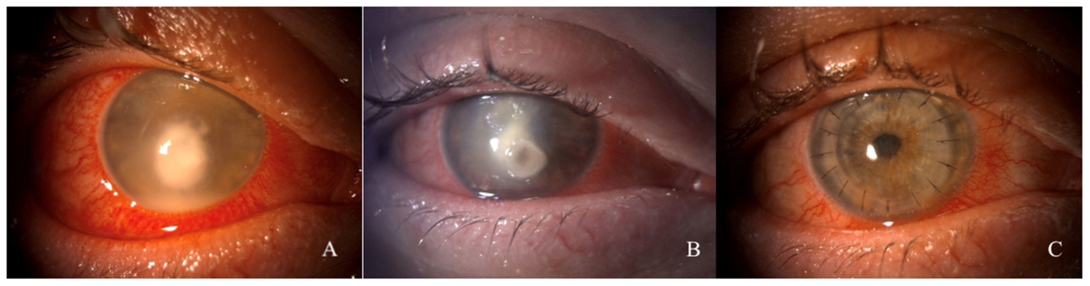 Microorganisms 12 00922 g002