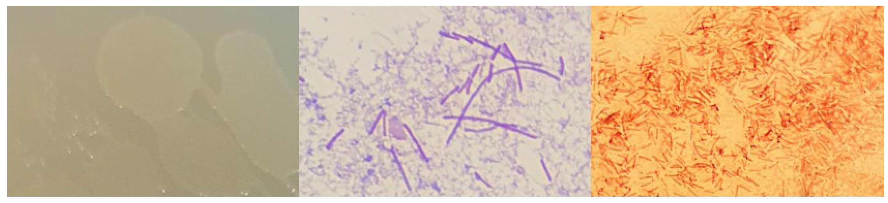 Microorganisms 12 01066 g0a1 Microorganisms 12 01066 g0a1