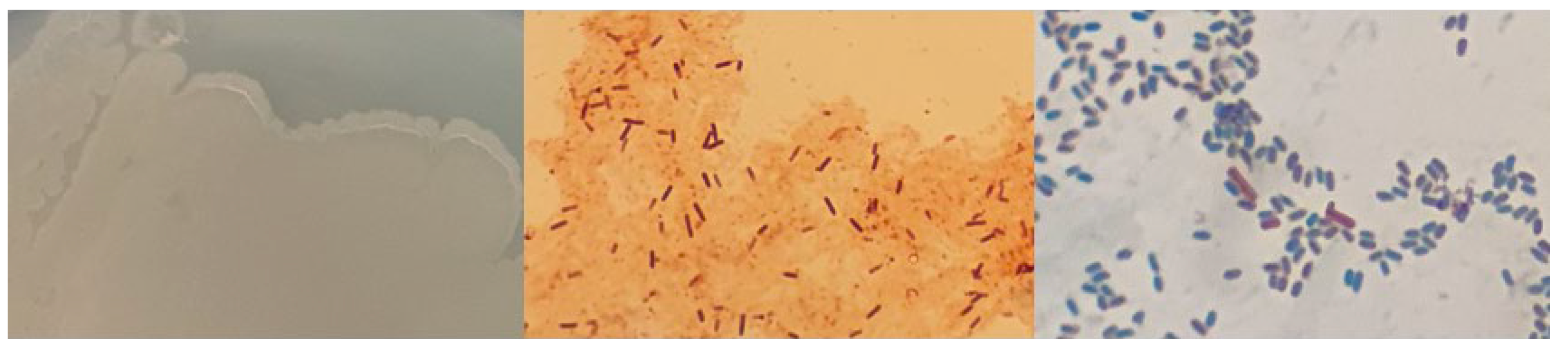 Microorganisms 12 01066 g0a10 Microorganisms 12 01066 g0a10