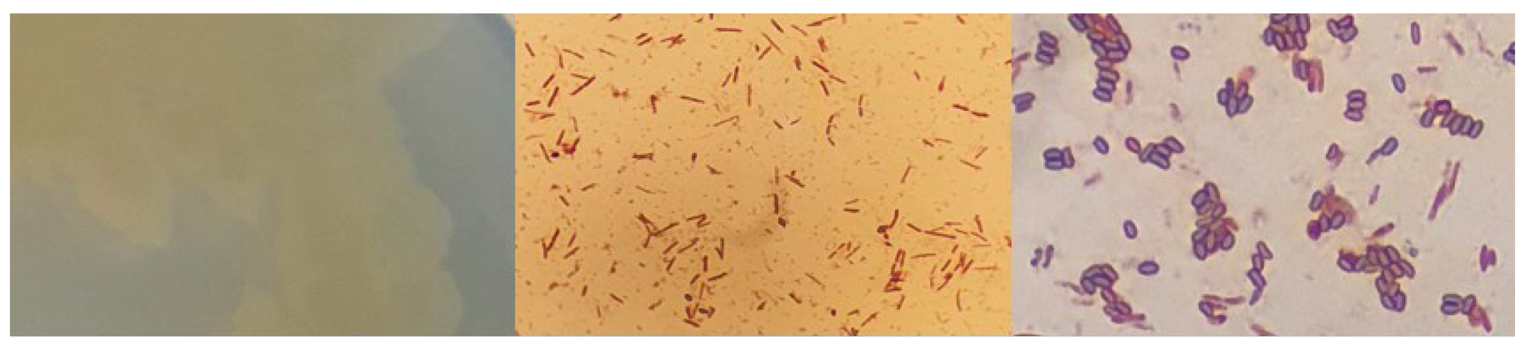 Microorganisms 12 01066 g0a11 Microorganisms 12 01066 g0a11
