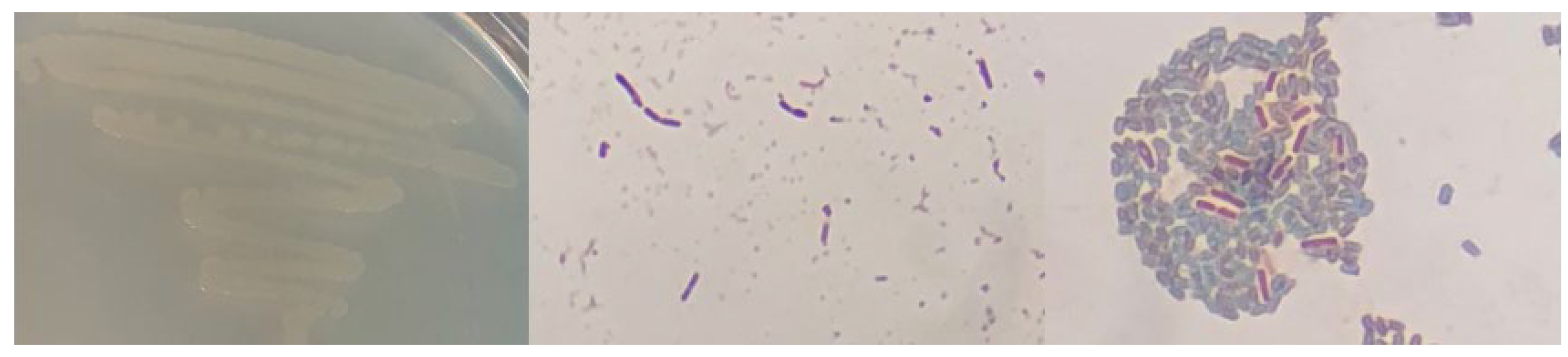 Microorganisms 12 01066 g0a16 Microorganisms 12 01066 g0a16