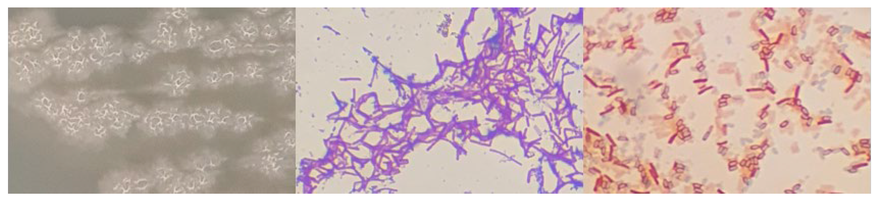 Microorganisms 12 01066 g0a2 Microorganisms 12 01066 g0a2