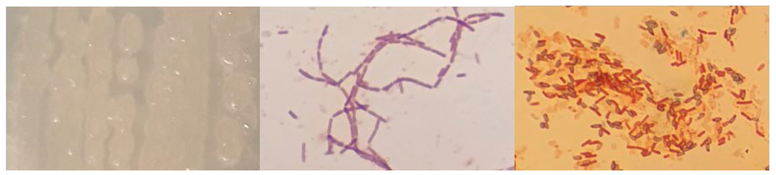 Microorganisms 12 01066 g0a7 Microorganisms 12 01066 g0a7