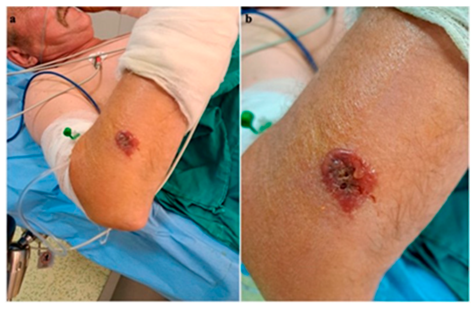 Microorganisms 12 01240 g001 Microorganisms 12 01240 g001