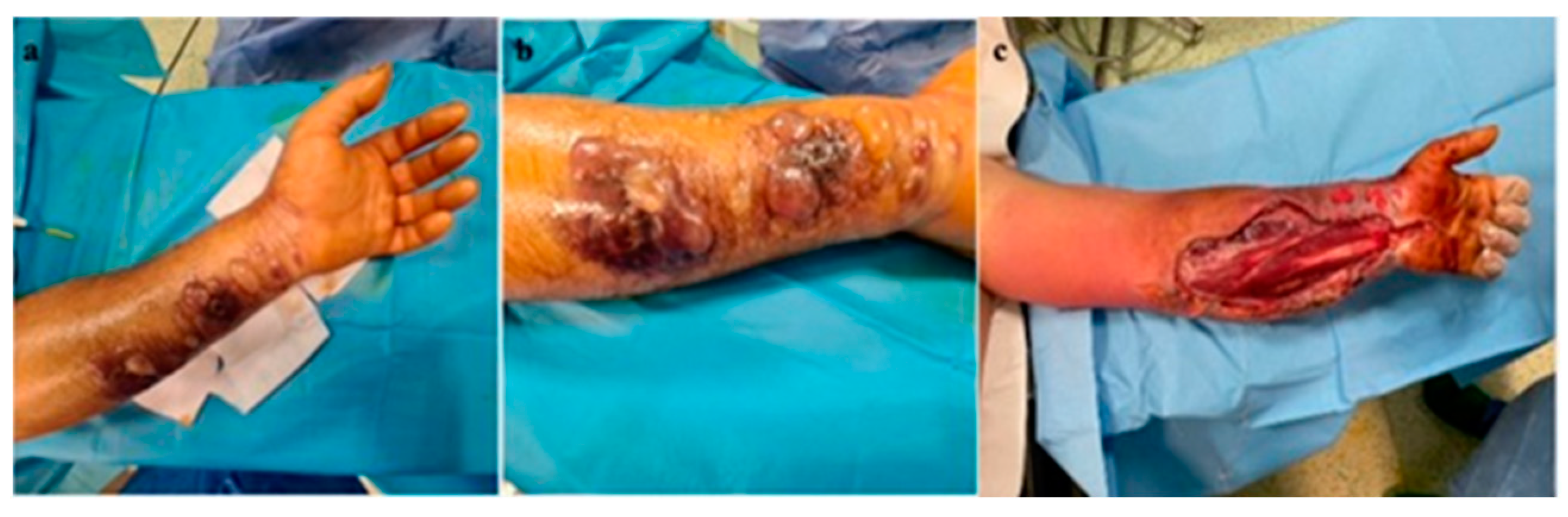 Microorganisms 12 01240 g003 Microorganisms 12 01240 g003