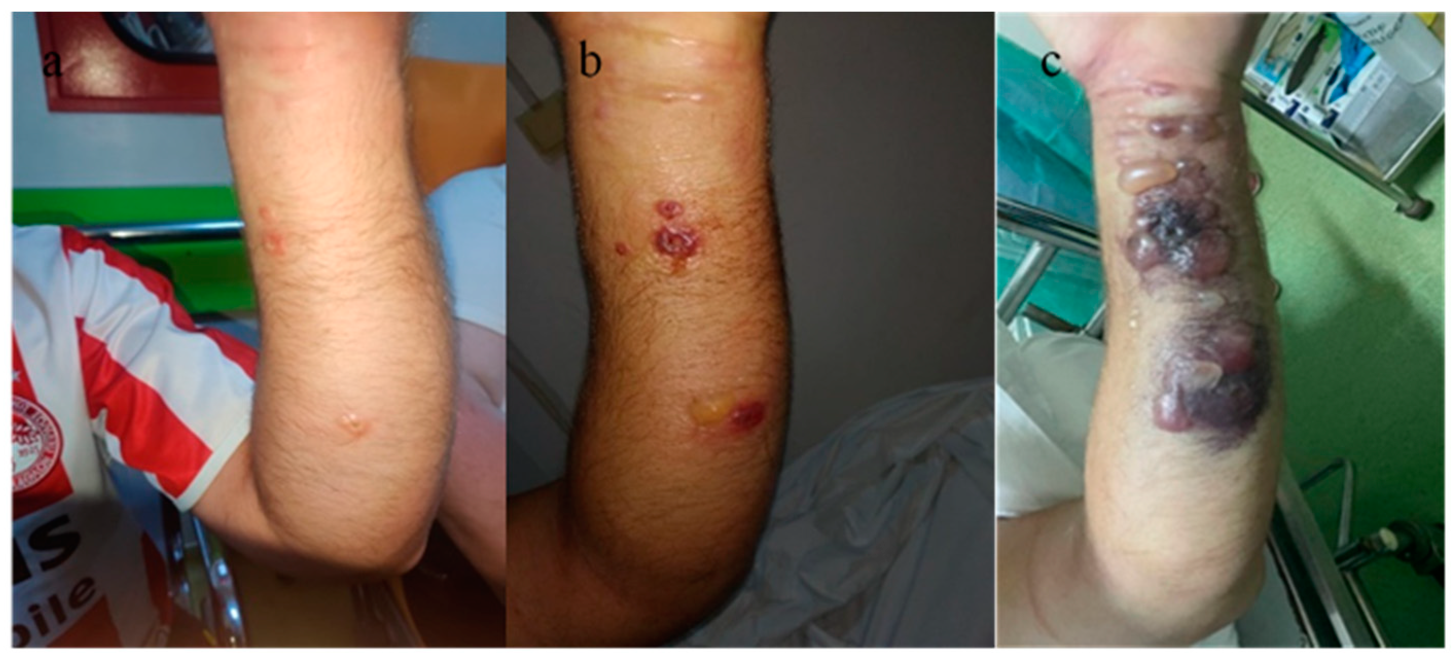 Microorganisms 12 01240 g009 Microorganisms 12 01240 g009