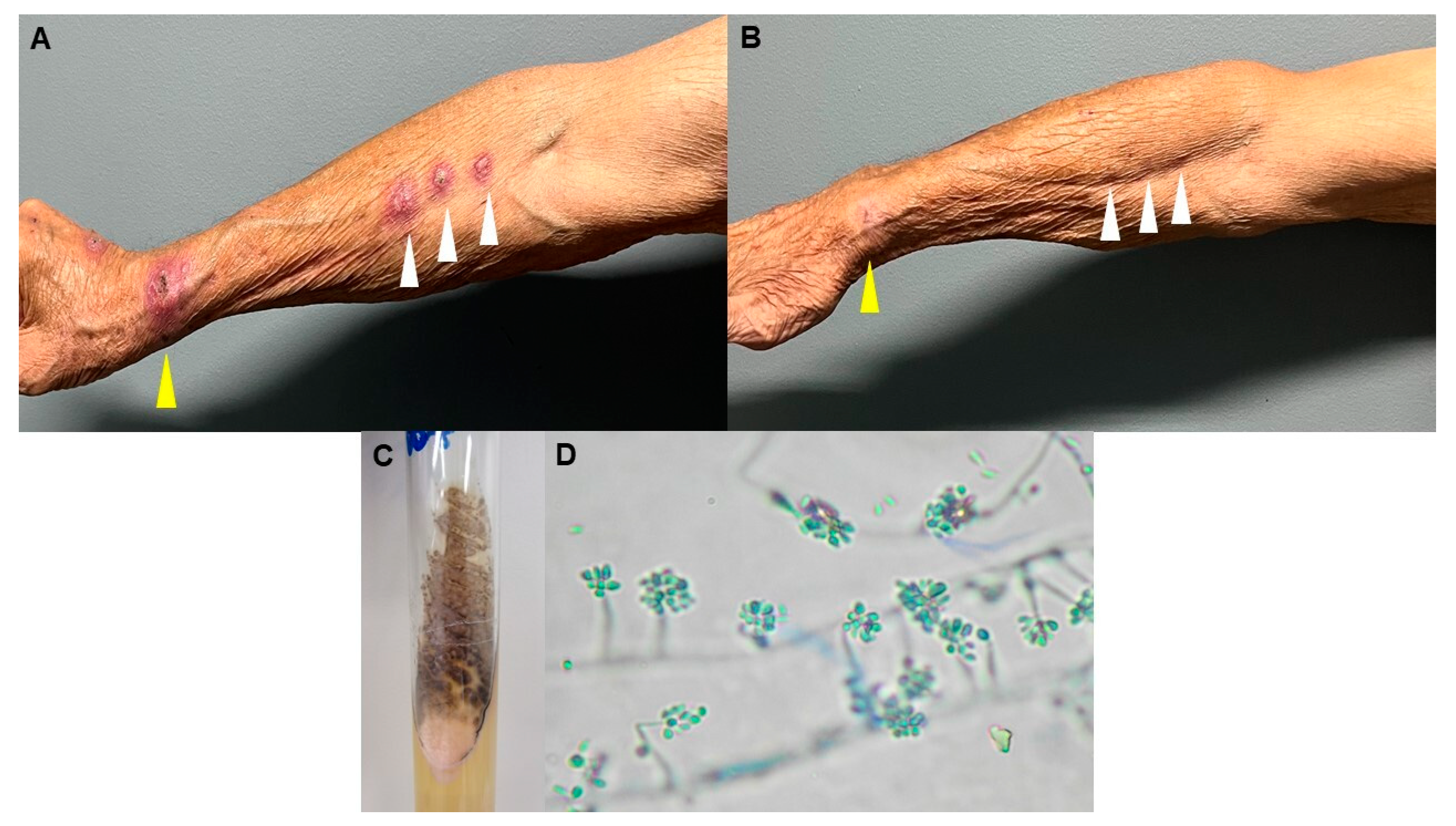 Microorganisms 12 02132 g001