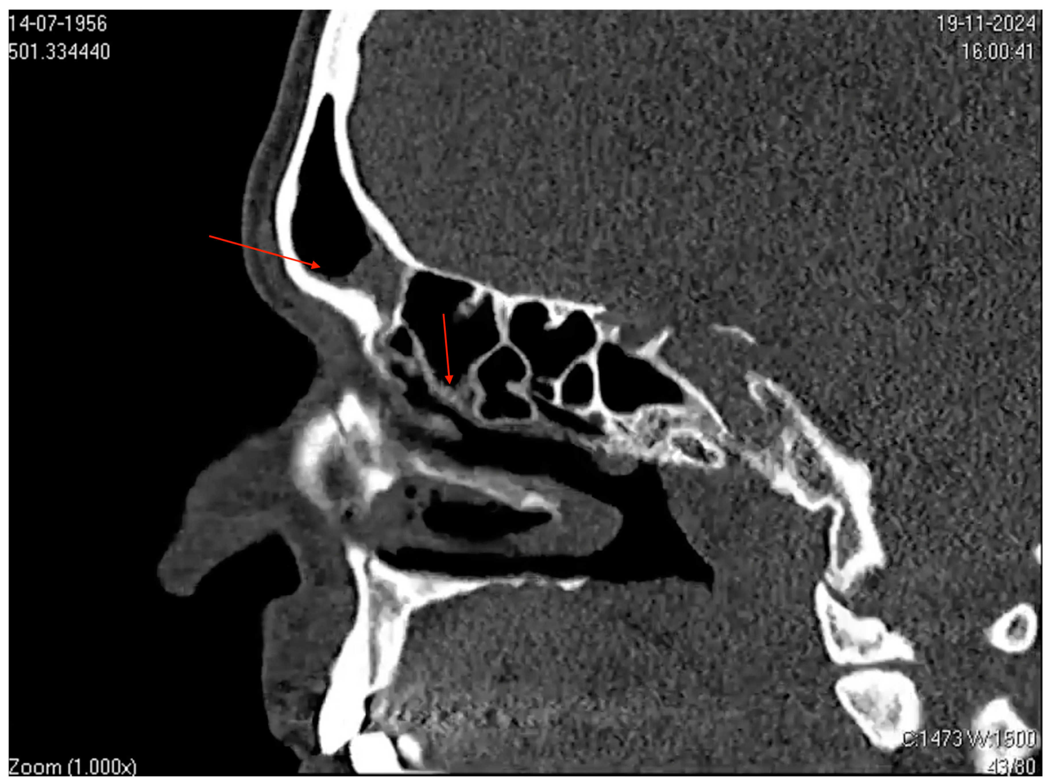 Microorganisms 13 00073 g003