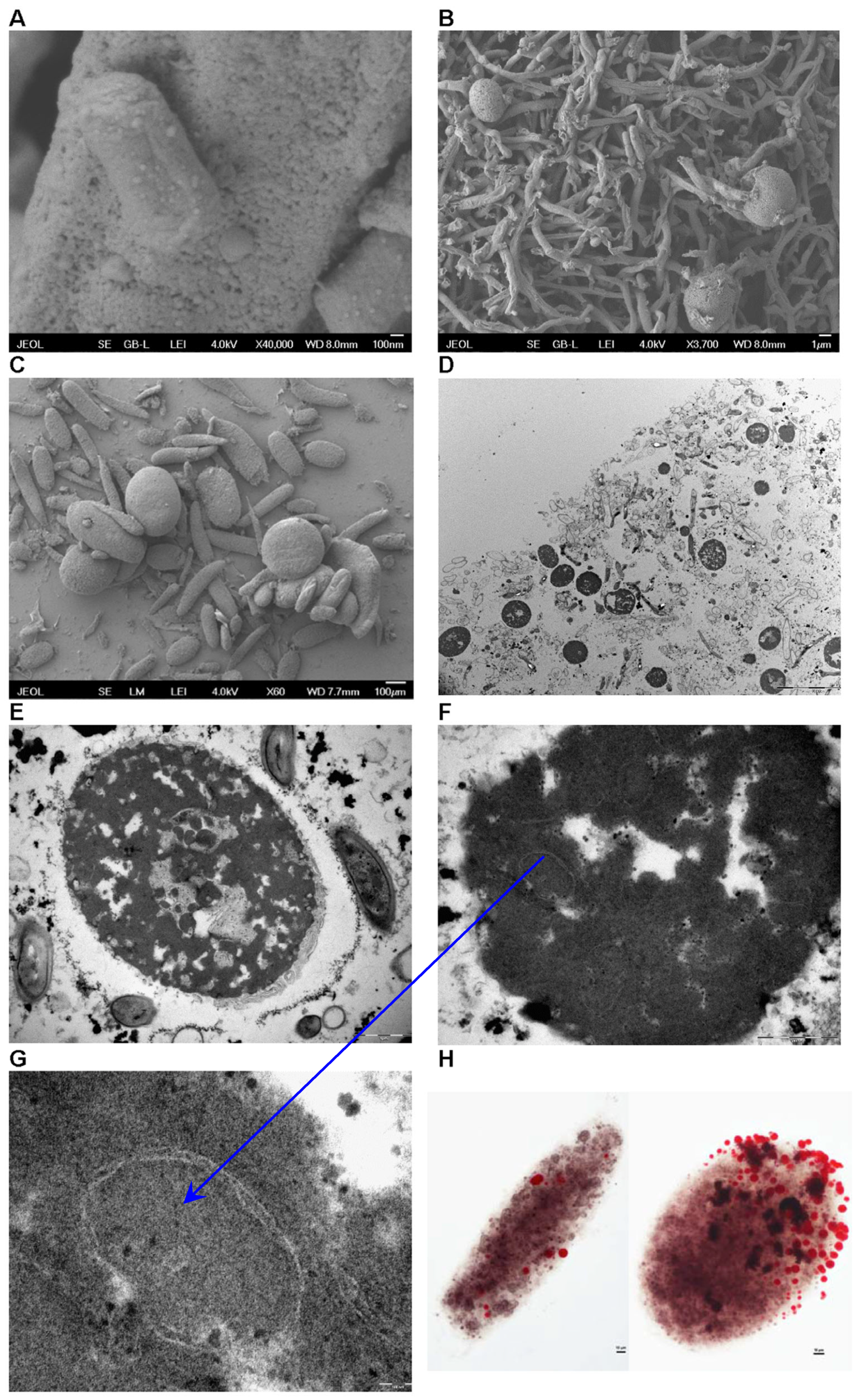 Microorganisms 13 00107 g008