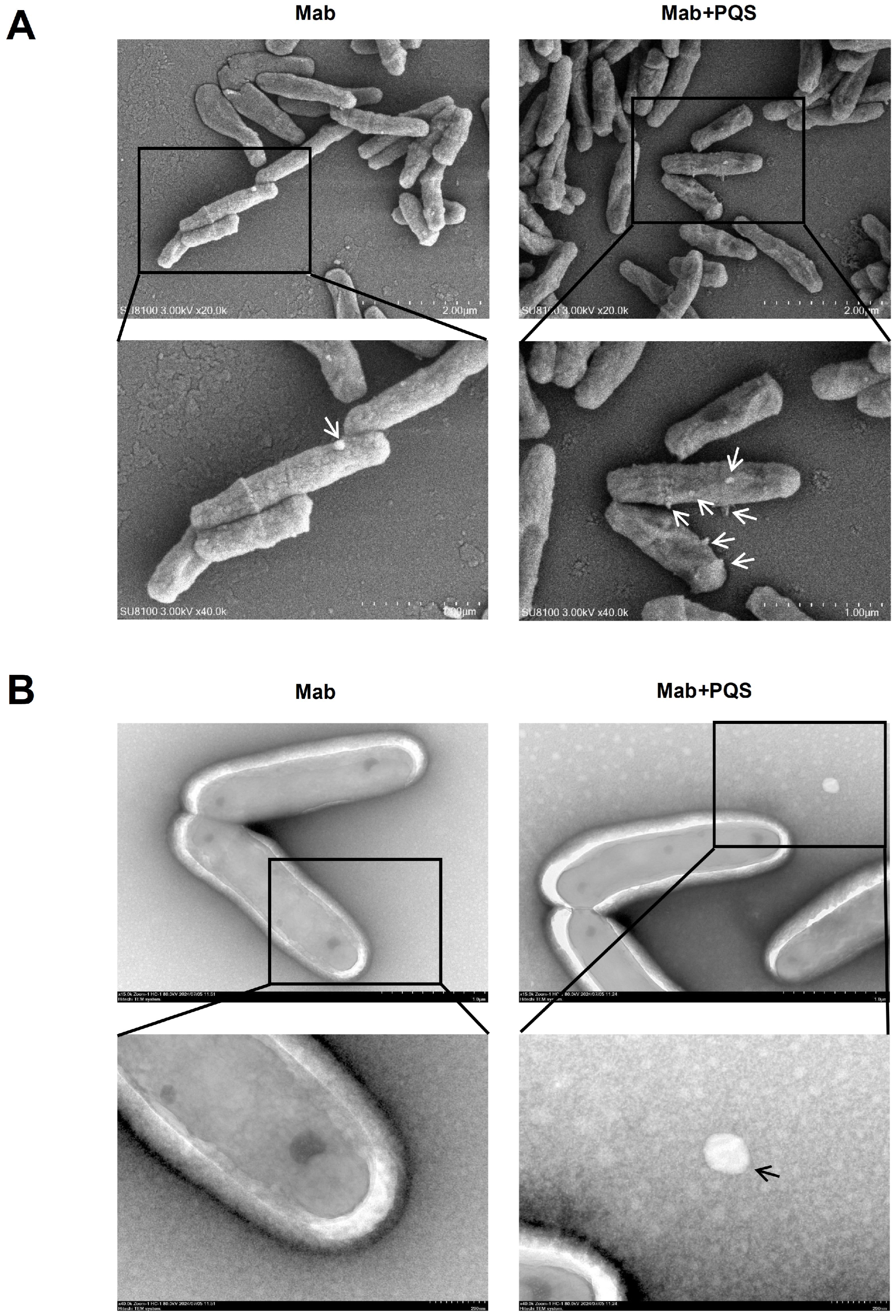 Microorganisms 13 00116 g004