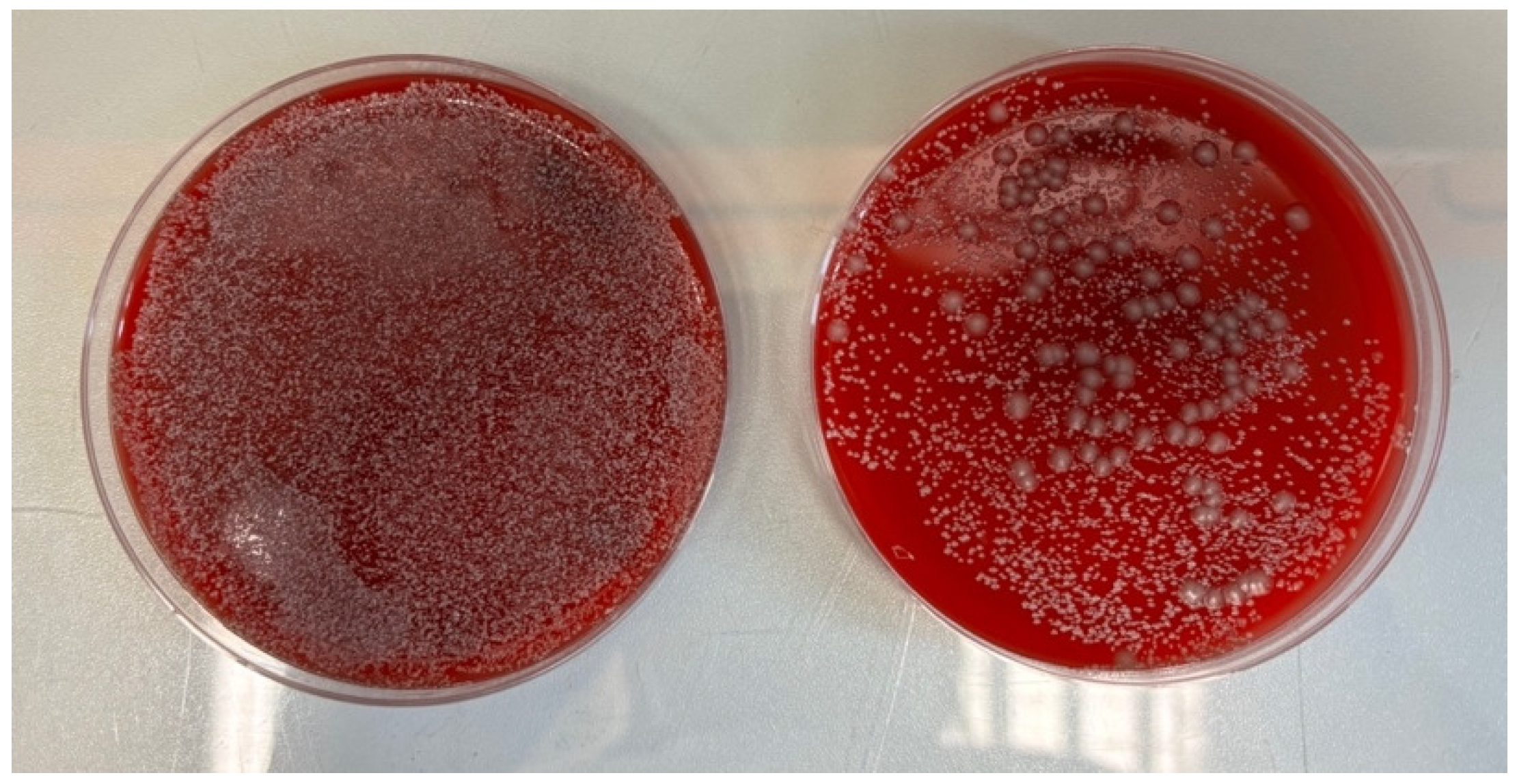 Microorganisms 13 00152 g005
