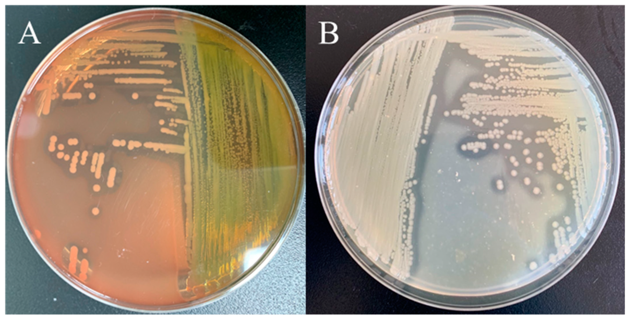 Microorganisms 13 00278 g004 Microorganisms 13 00278 g004
