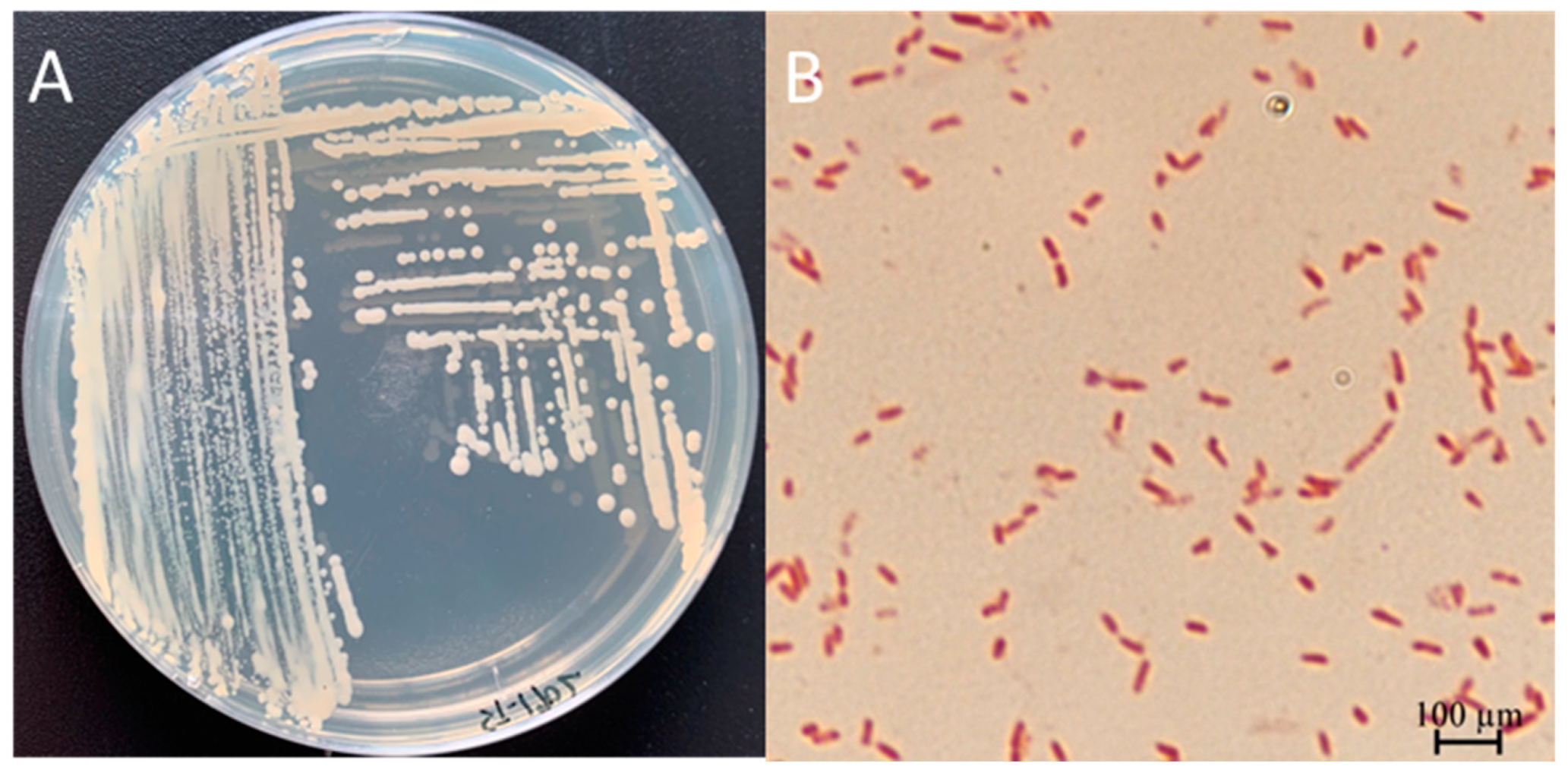 Microorganisms 13 00278 g0a1 Microorganisms 13 00278 g0a1