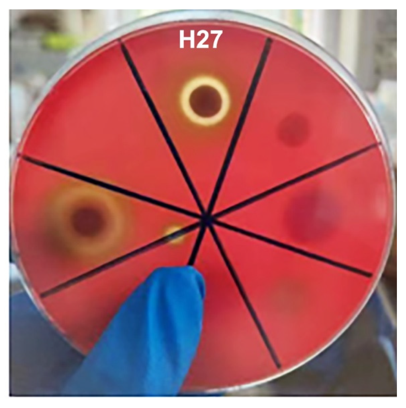 Microorganisms 13 00296 g004