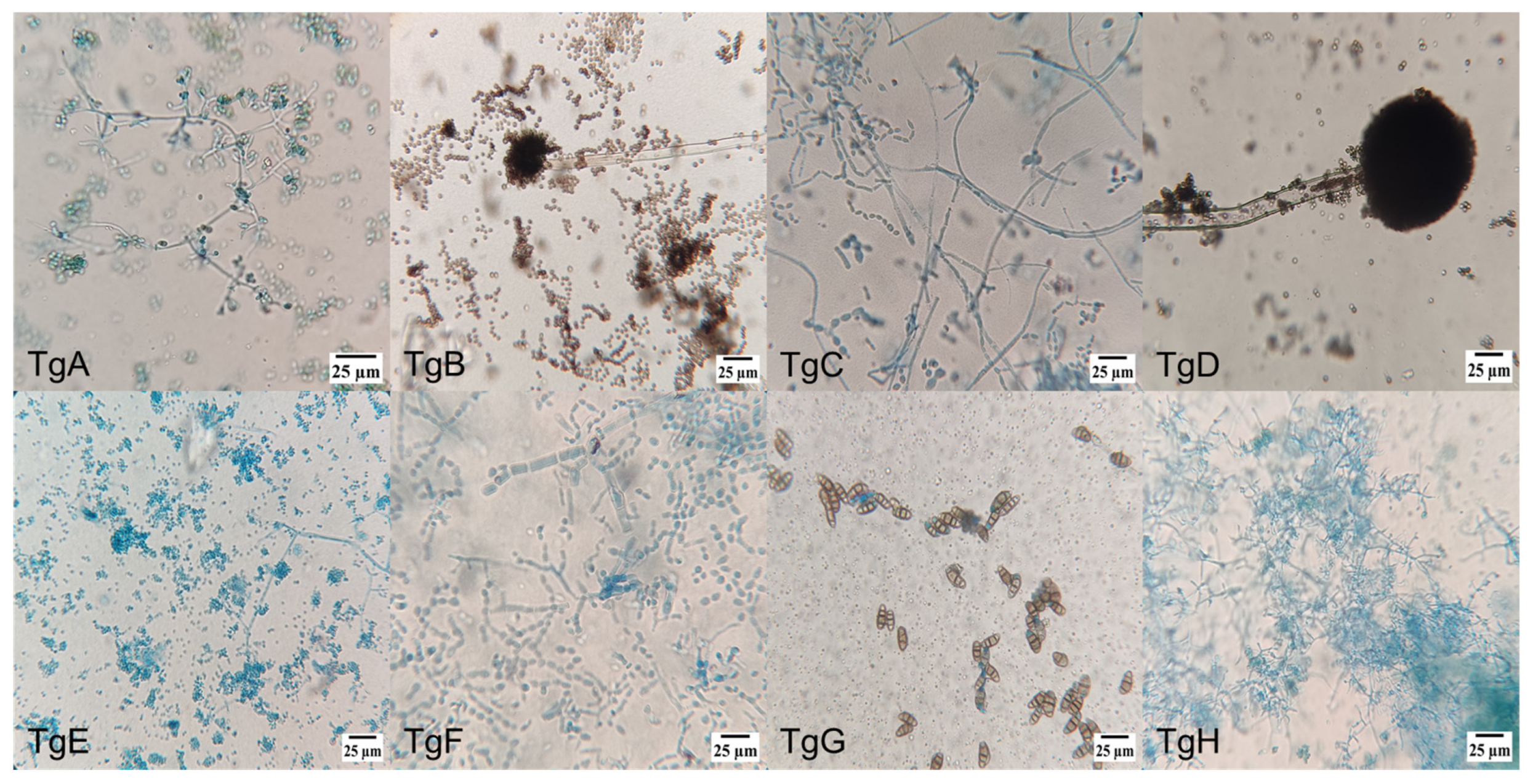 Microorganisms 13 00300 g001a