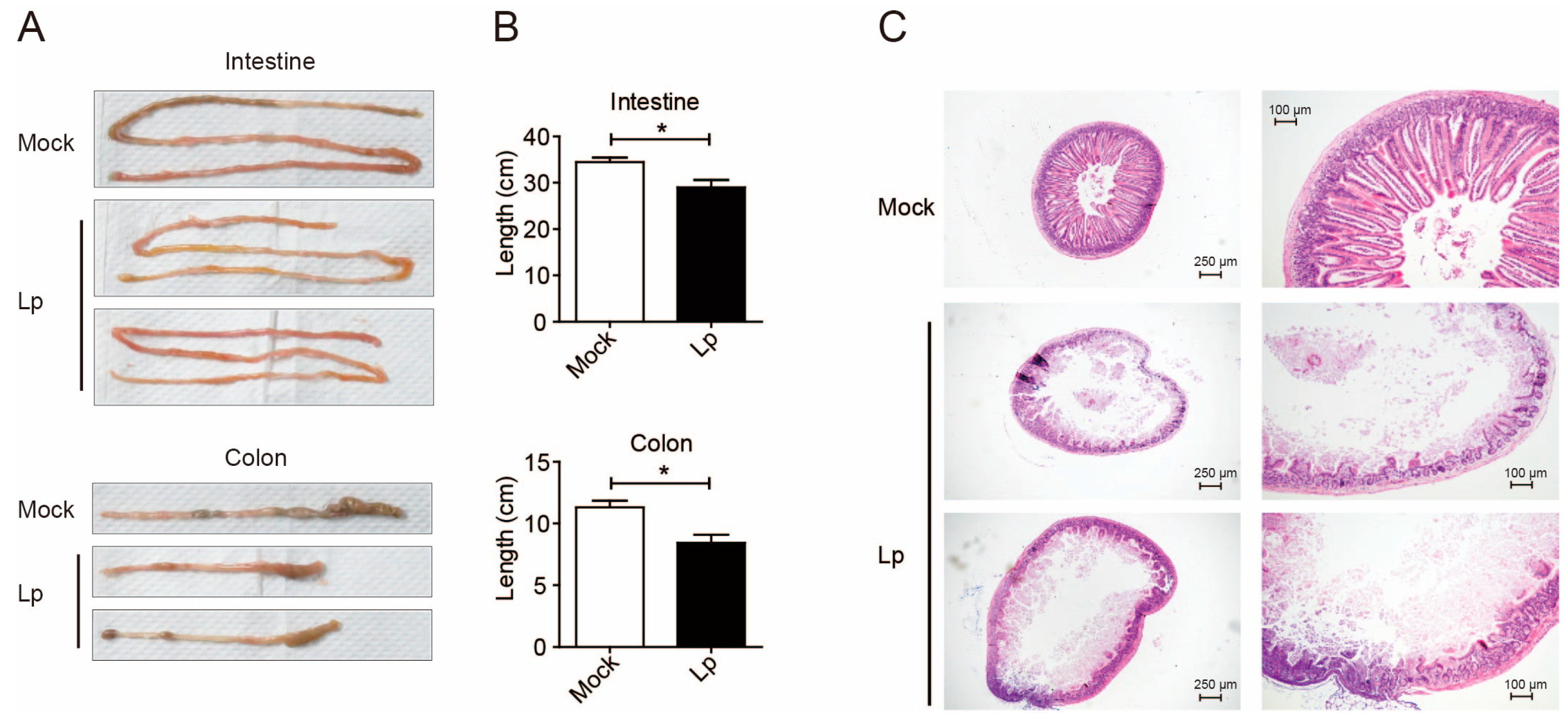 Microorganisms 13 00313 g001