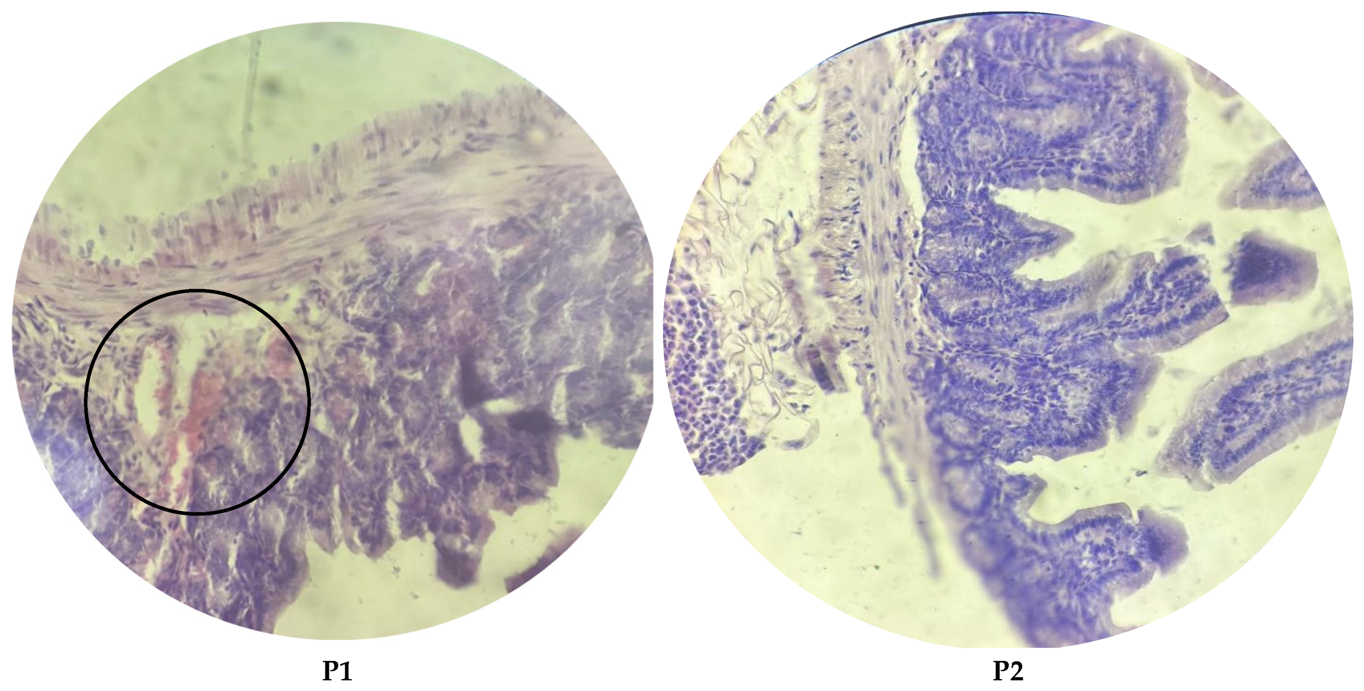 Microorganisms 13 00460 g005